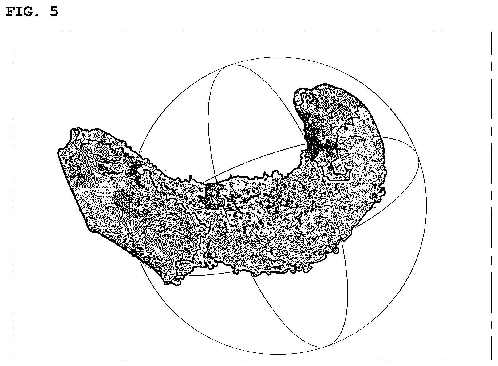 Patent US12333648 Figure 4 – Method and apparatus for reconstructing images of inside of body obtained through endoscope device