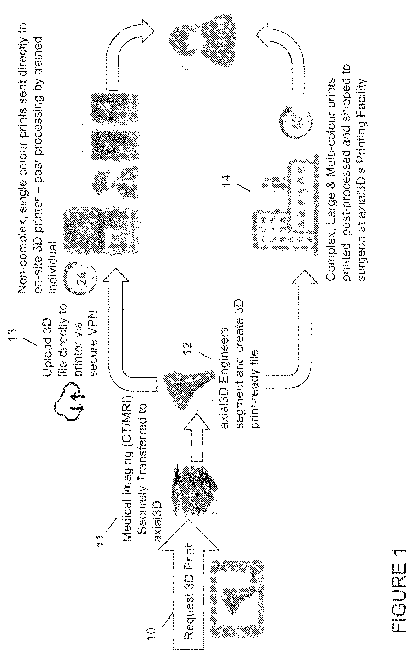 Patent US12333652 — Method for generating a 3D printable model of a patient specific anatomy — Figure 1