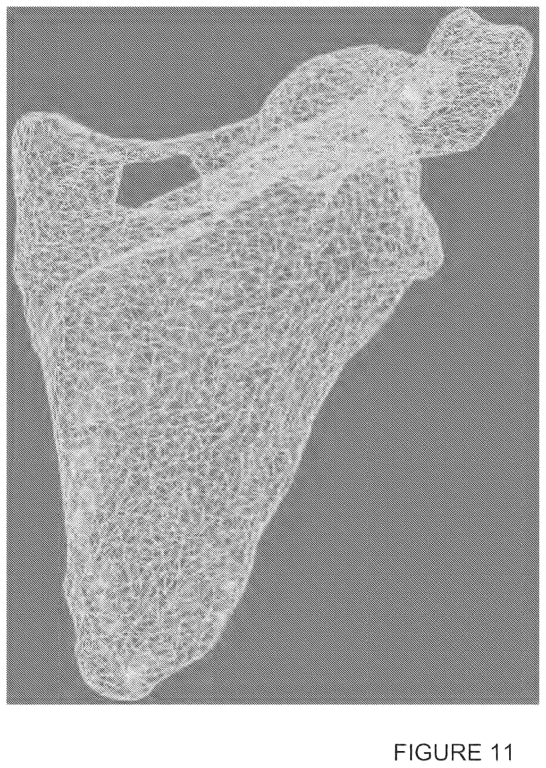 Patent US12333652 Figure 11 – Method for generating a 3D printable model of a patient specific anatomy