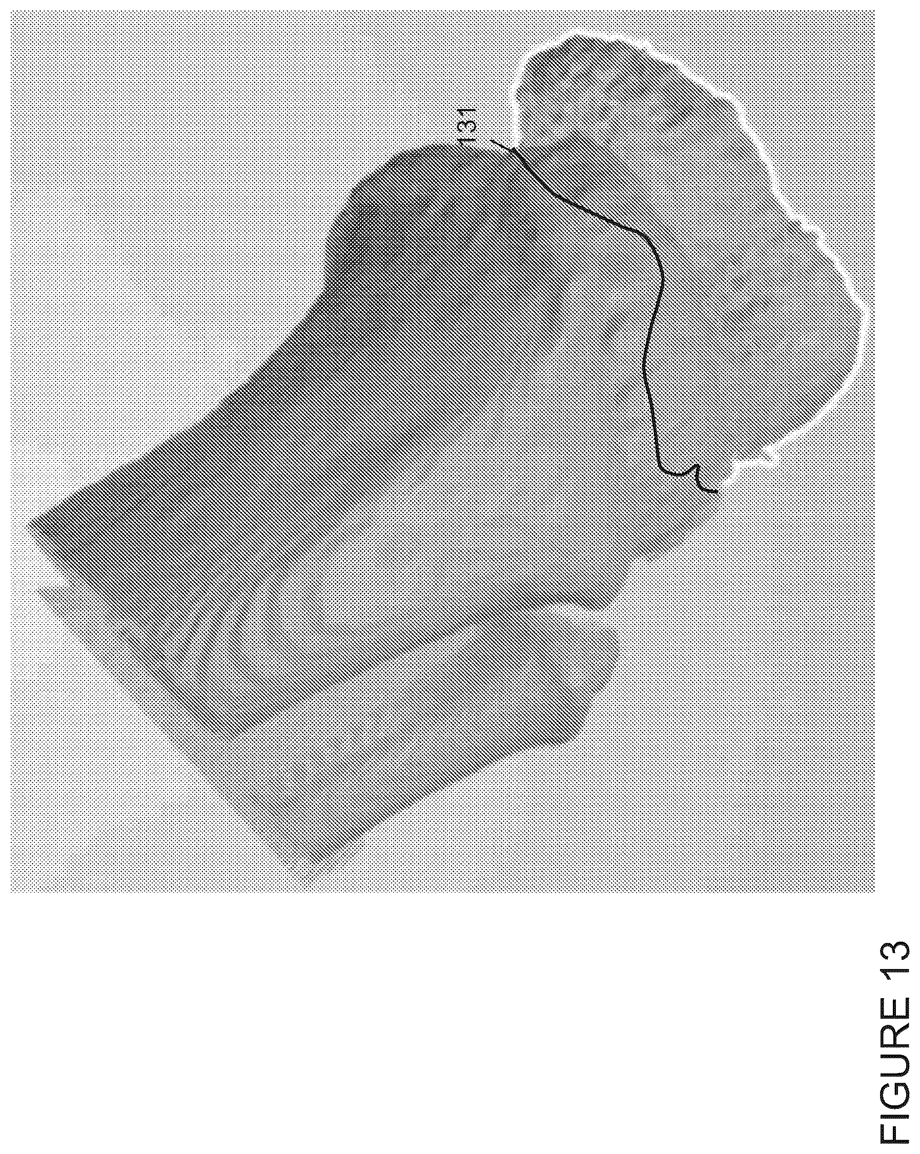Patent US12333652 Figure 13 – Method for generating a 3D printable model of a patient specific anatomy