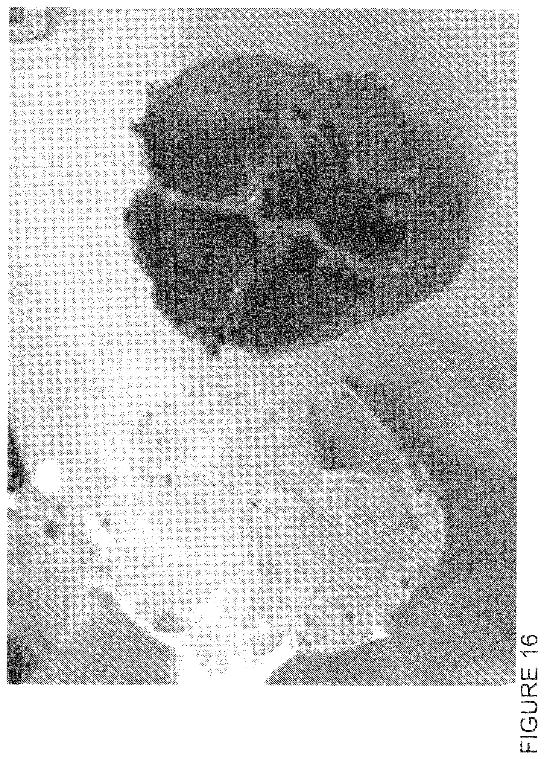 Patent US12333652 Figure 16 – Method for generating a 3D printable model of a patient specific anatomy