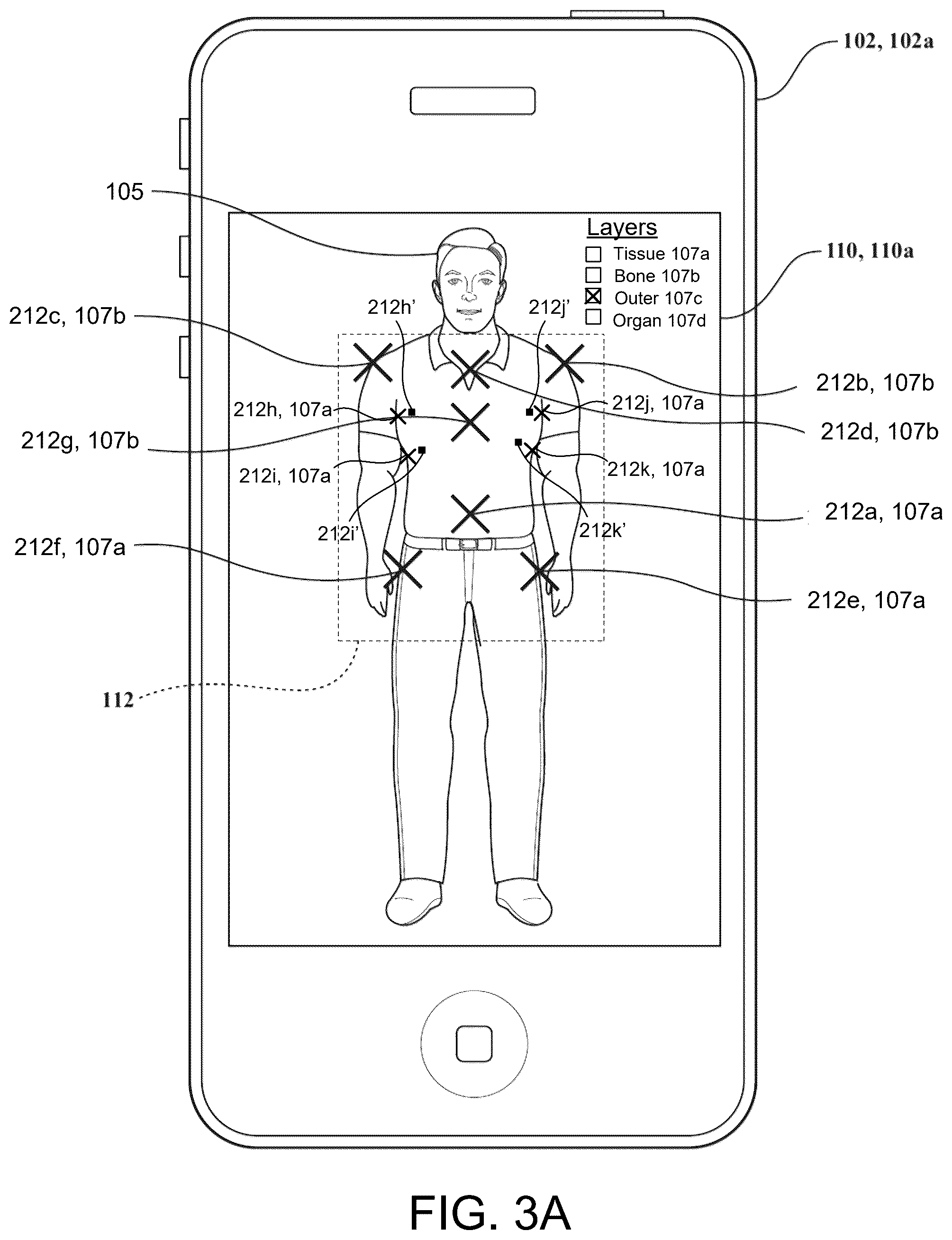 Patent US12333659 Figure 4 – Systems and methods for displaying layered augmented anatomical features
