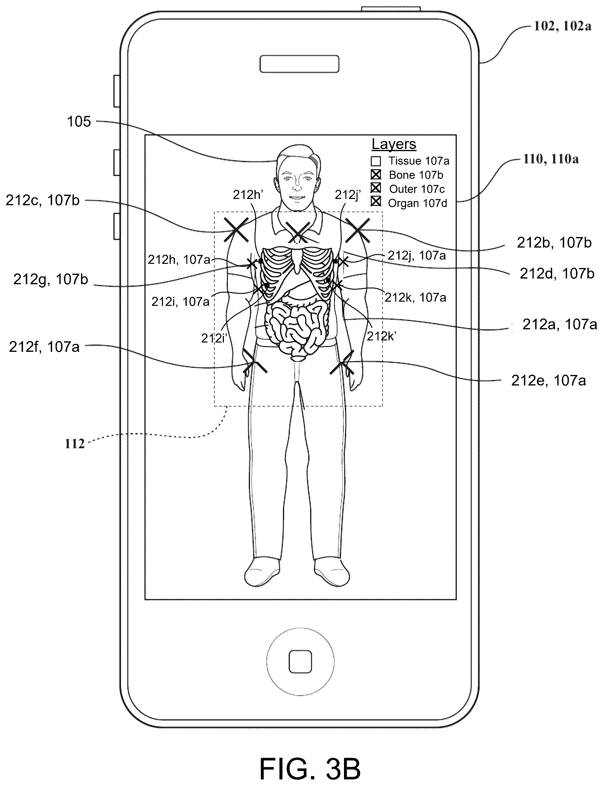 Patent US12333659 Figure 5 – Systems and methods for displaying layered augmented anatomical features