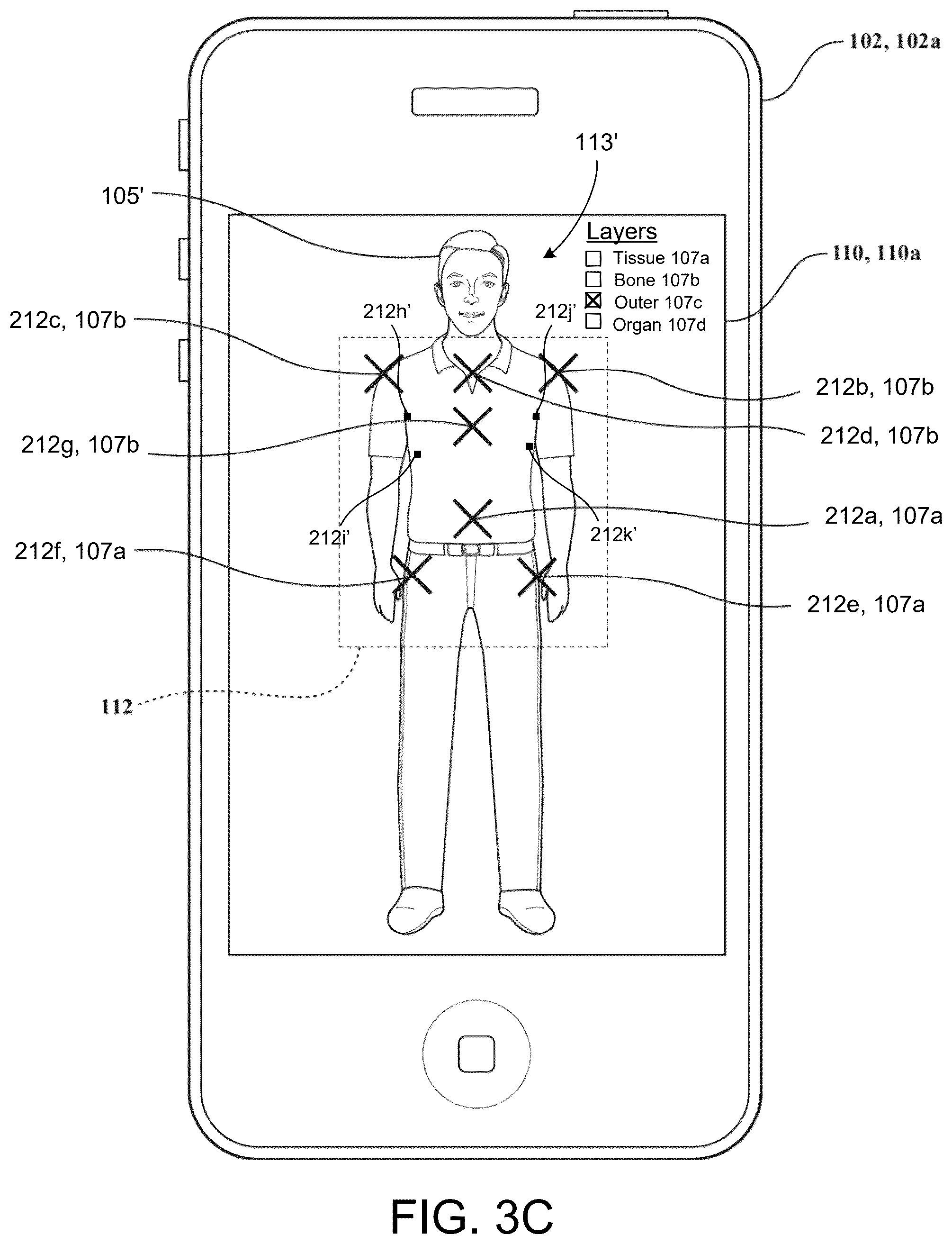 Patent US12333659 Figure 6 – Systems and methods for displaying layered augmented anatomical features