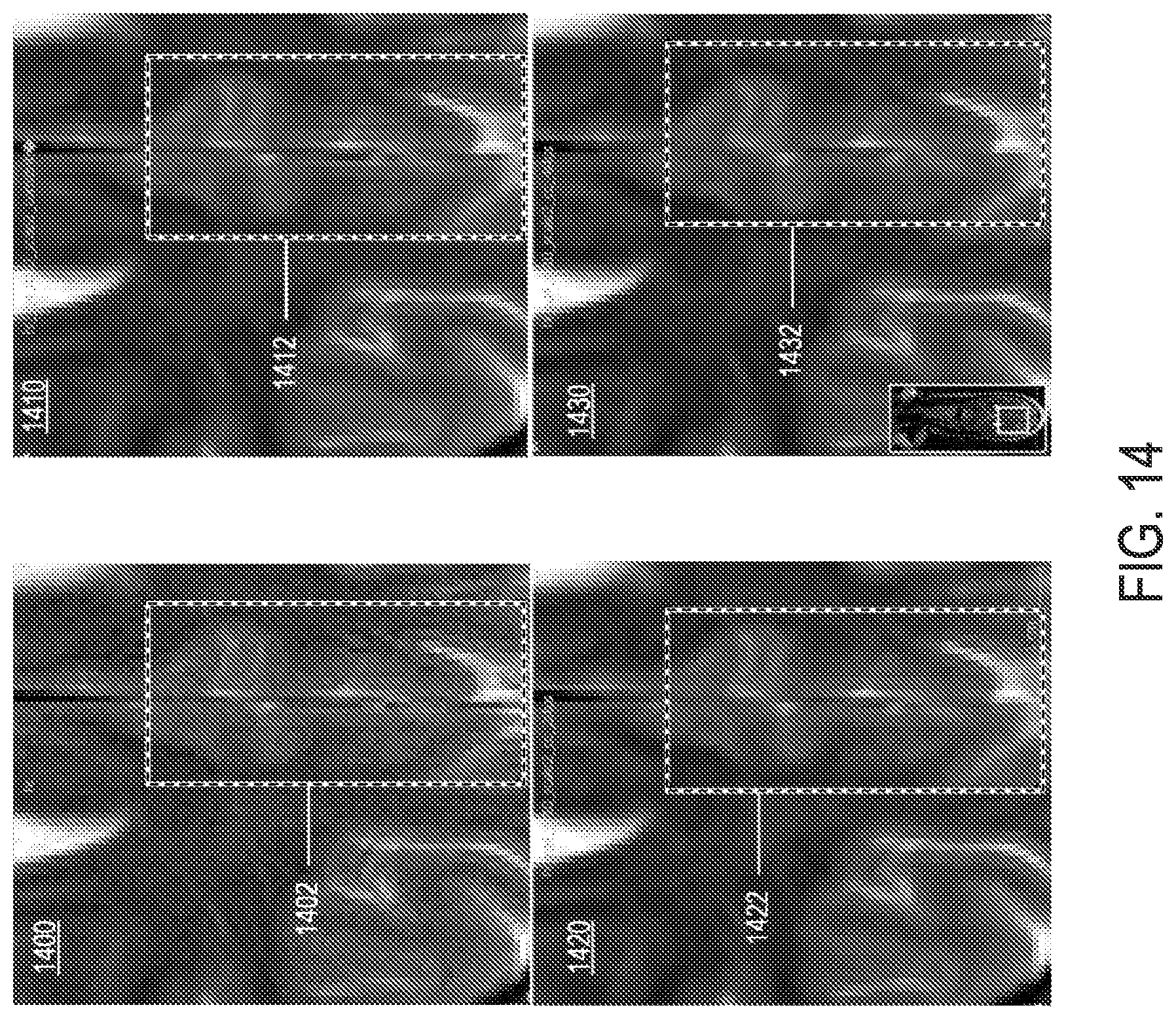 Patent US12333677 Figure 13 – Methods and systems for super-resolution with progressive sub-voxel up-sampling