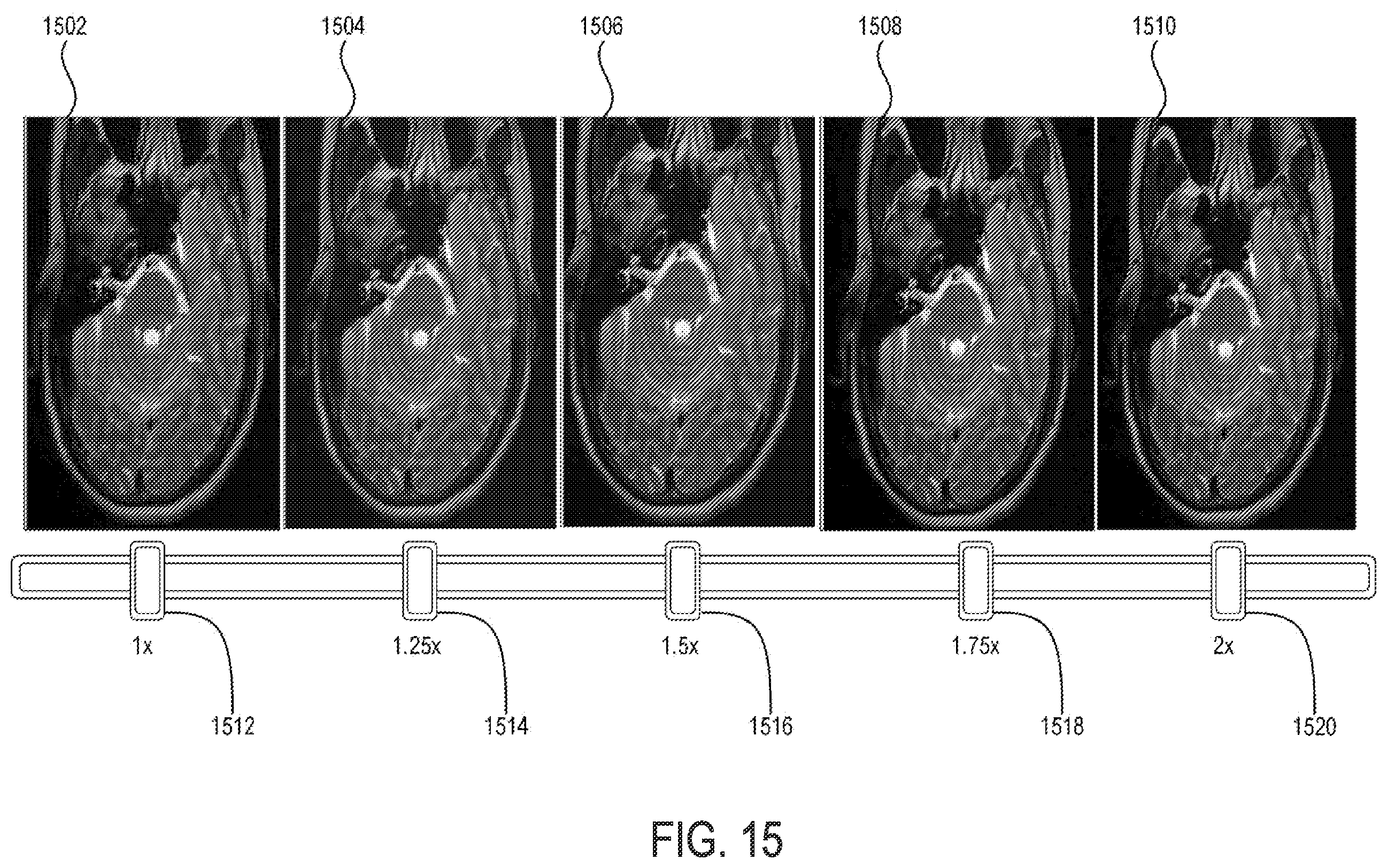 Patent US12333677 Figure 14 – Methods and systems for super-resolution with progressive sub-voxel up-sampling