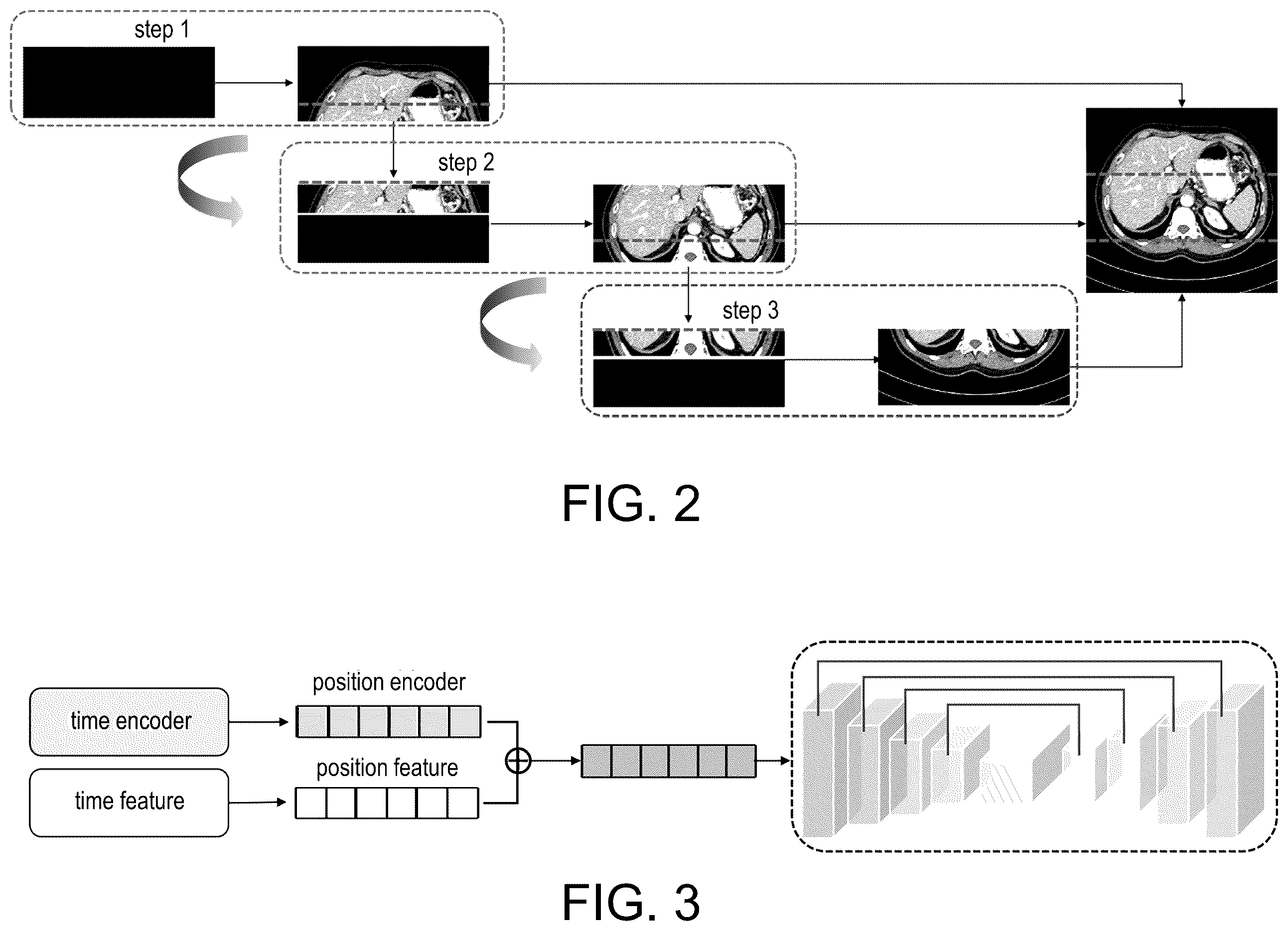 Patent US12333686 Figure 2 – Zero-shot low-dose CT image denoising method and apparatus based on strip diffusion model
