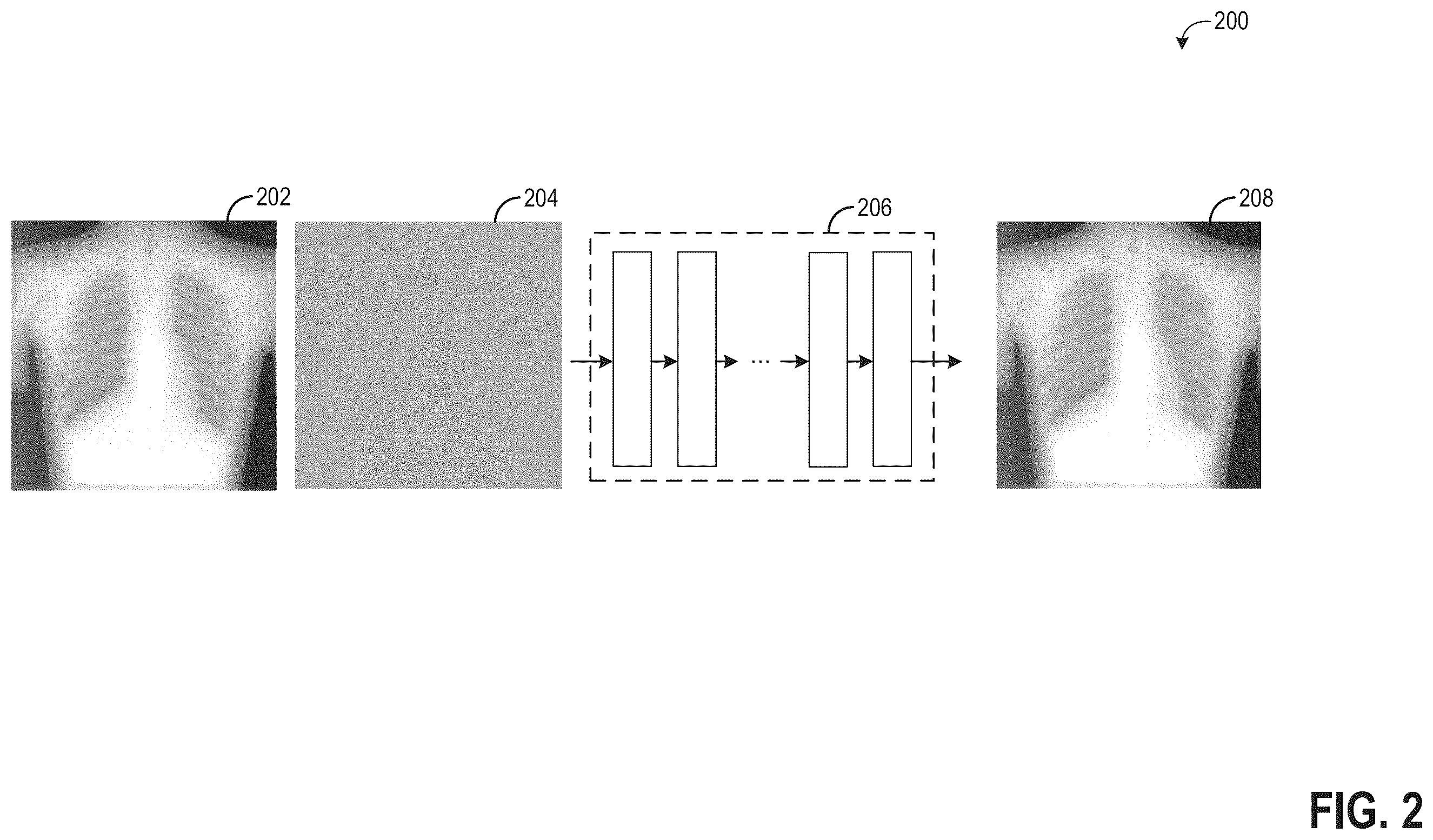 Patent US12333687 Figure 2 – Methods and systems for image denoising
