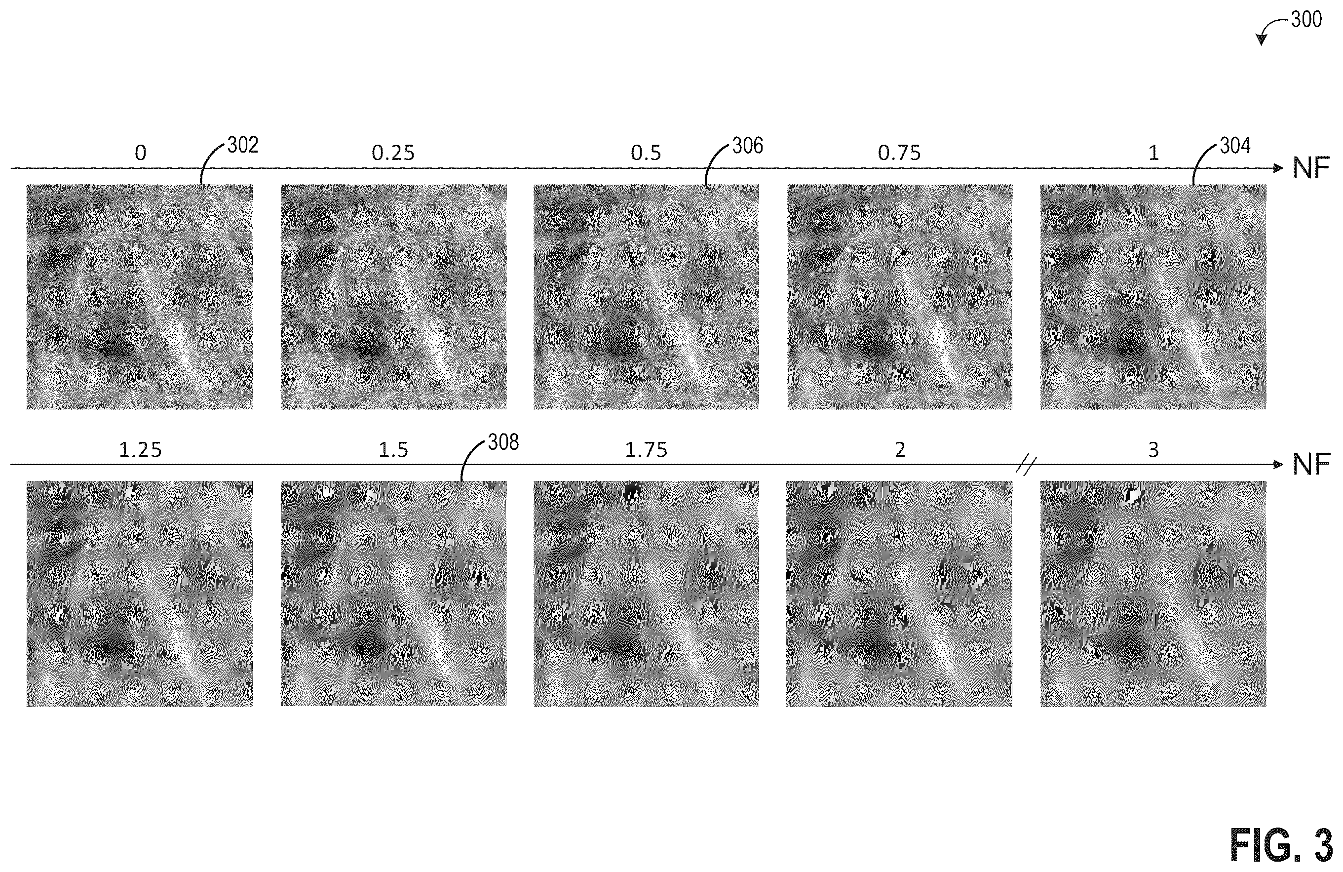 Patent US12333687 Figure 3 – Methods and systems for image denoising