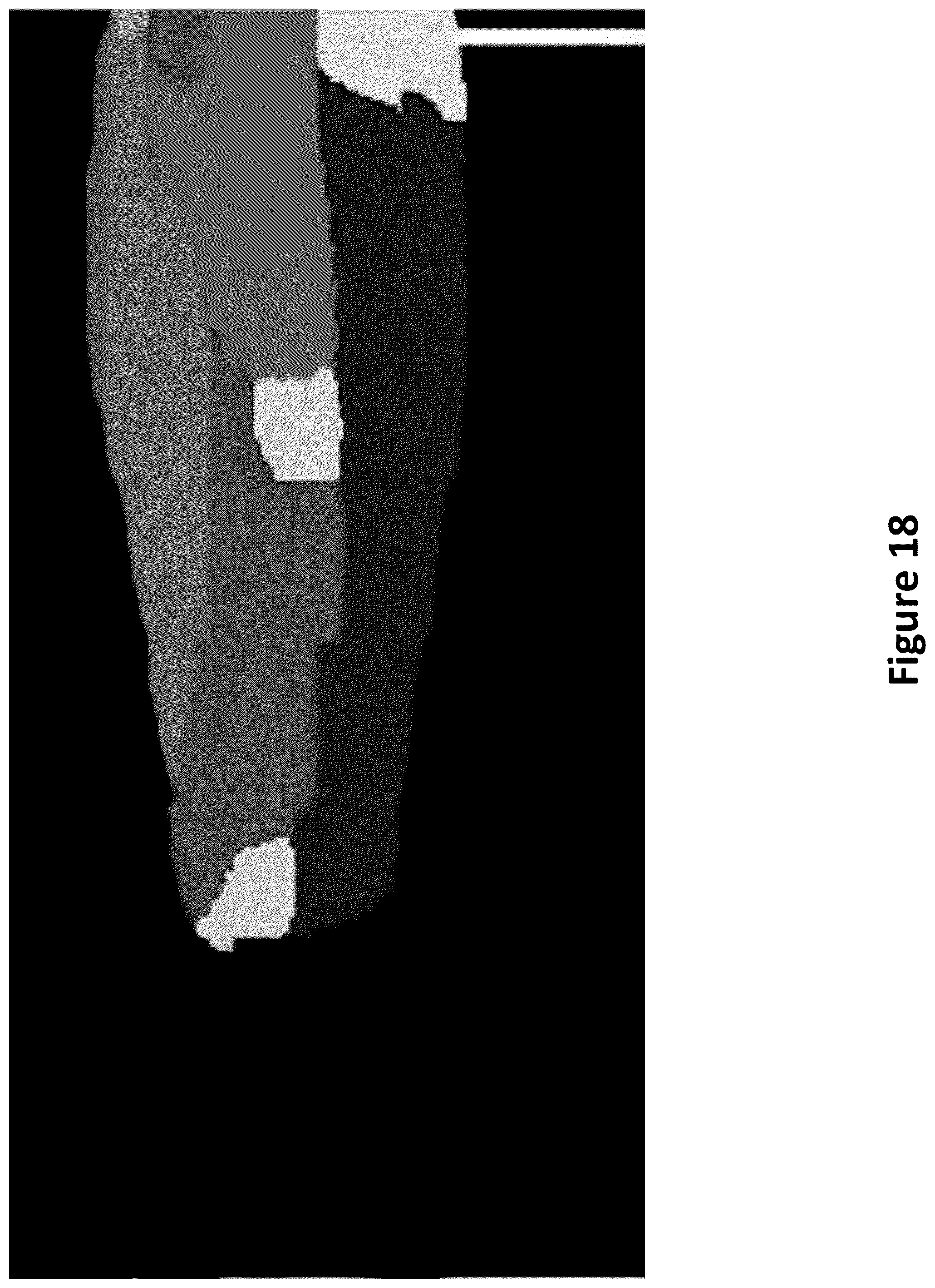 Patent US12333710 Figure 18 – Mobile multi-camera multi-view capture