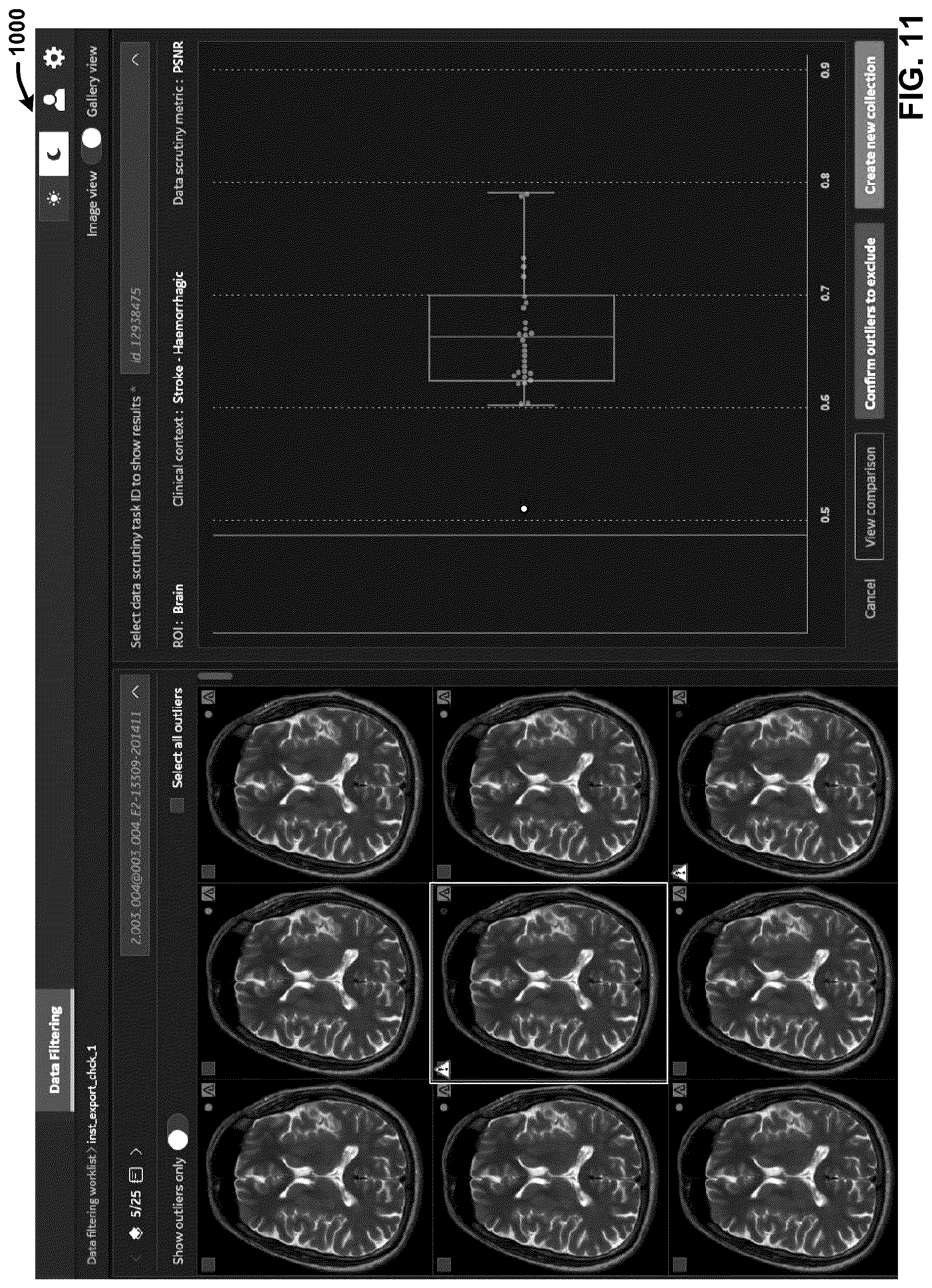 Patent US12333716 Figure 11 – Generating high quality training data collections for training artificial intelligence models