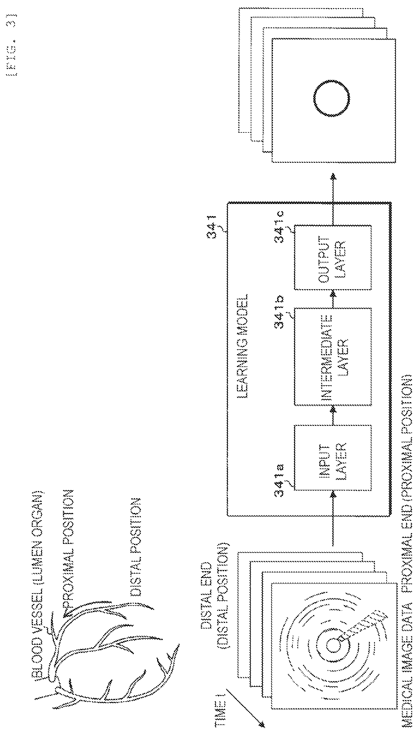 Patent US12333718 Figure 2 – Method for generating model by recognizing cross-section regions in units of pixels