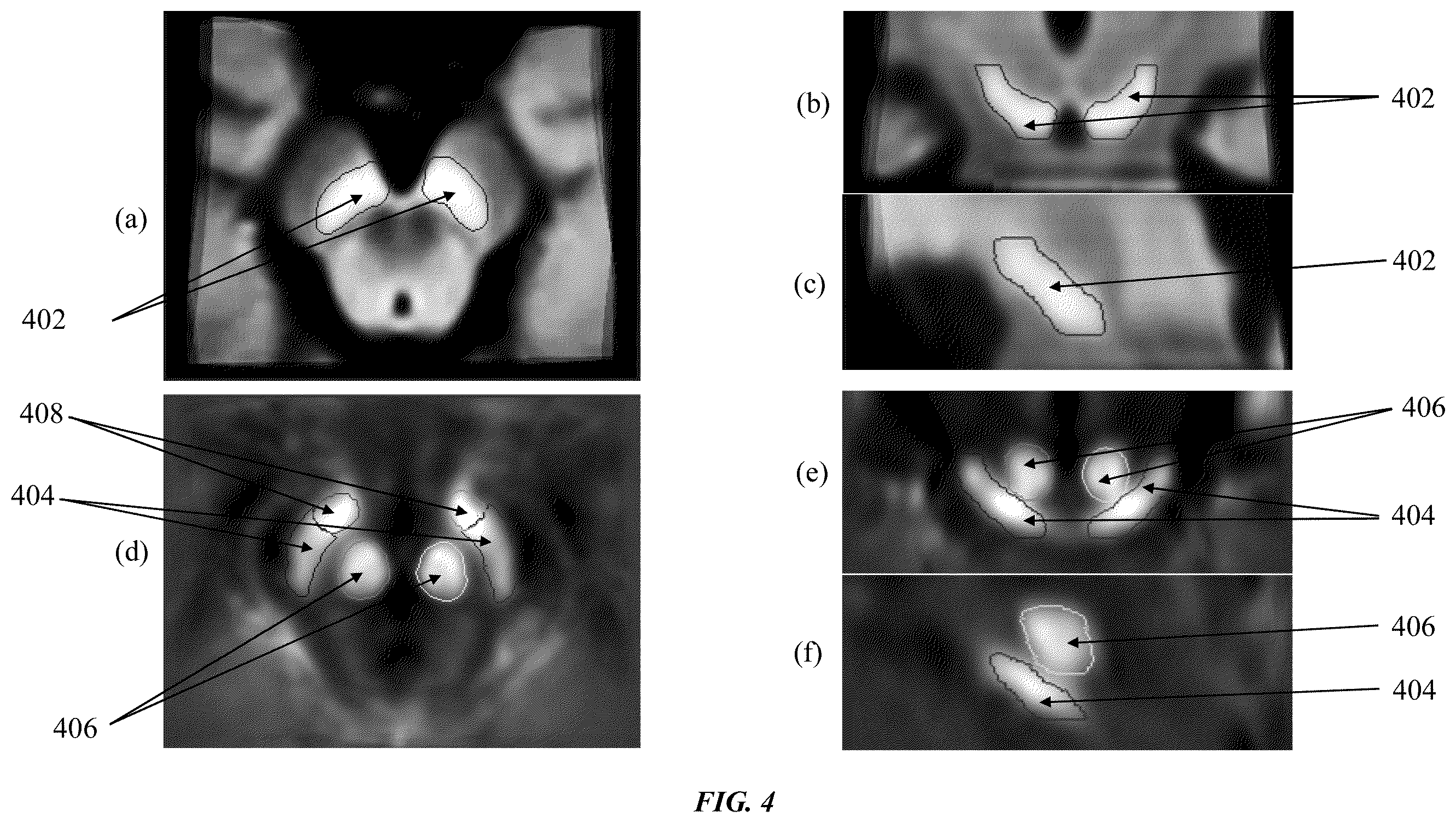 Patent US12333720 Figure 4 – Systems and methods for template-based automatic detection of anatomical structures