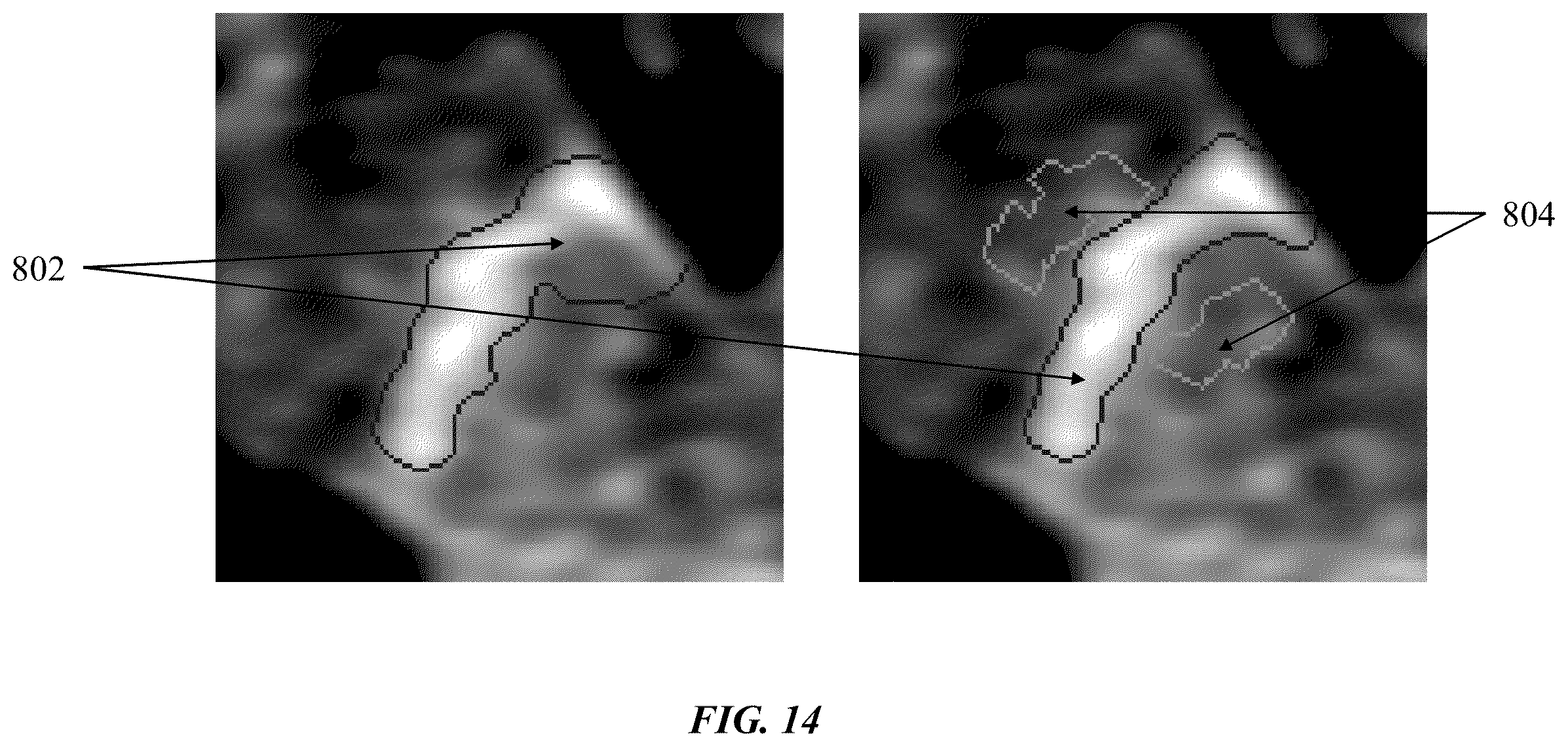 Patent US12333720 Figure 16 – Systems and methods for template-based automatic detection of anatomical structures