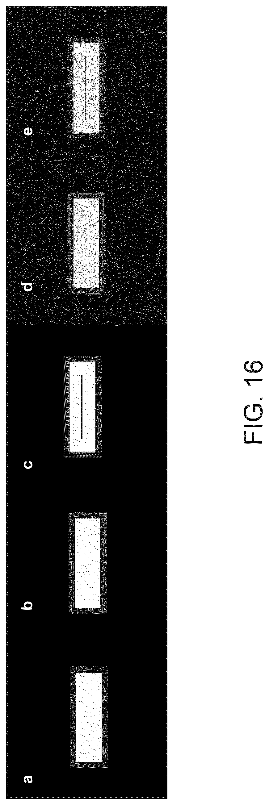 Patent US12333720 Figure 18 – Systems and methods for template-based automatic detection of anatomical structures