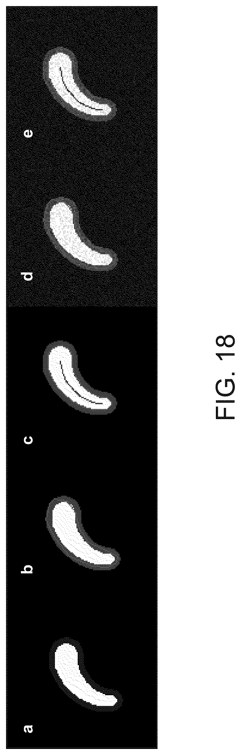 Patent US12333720 Figure 20 – Systems and methods for template-based automatic detection of anatomical structures