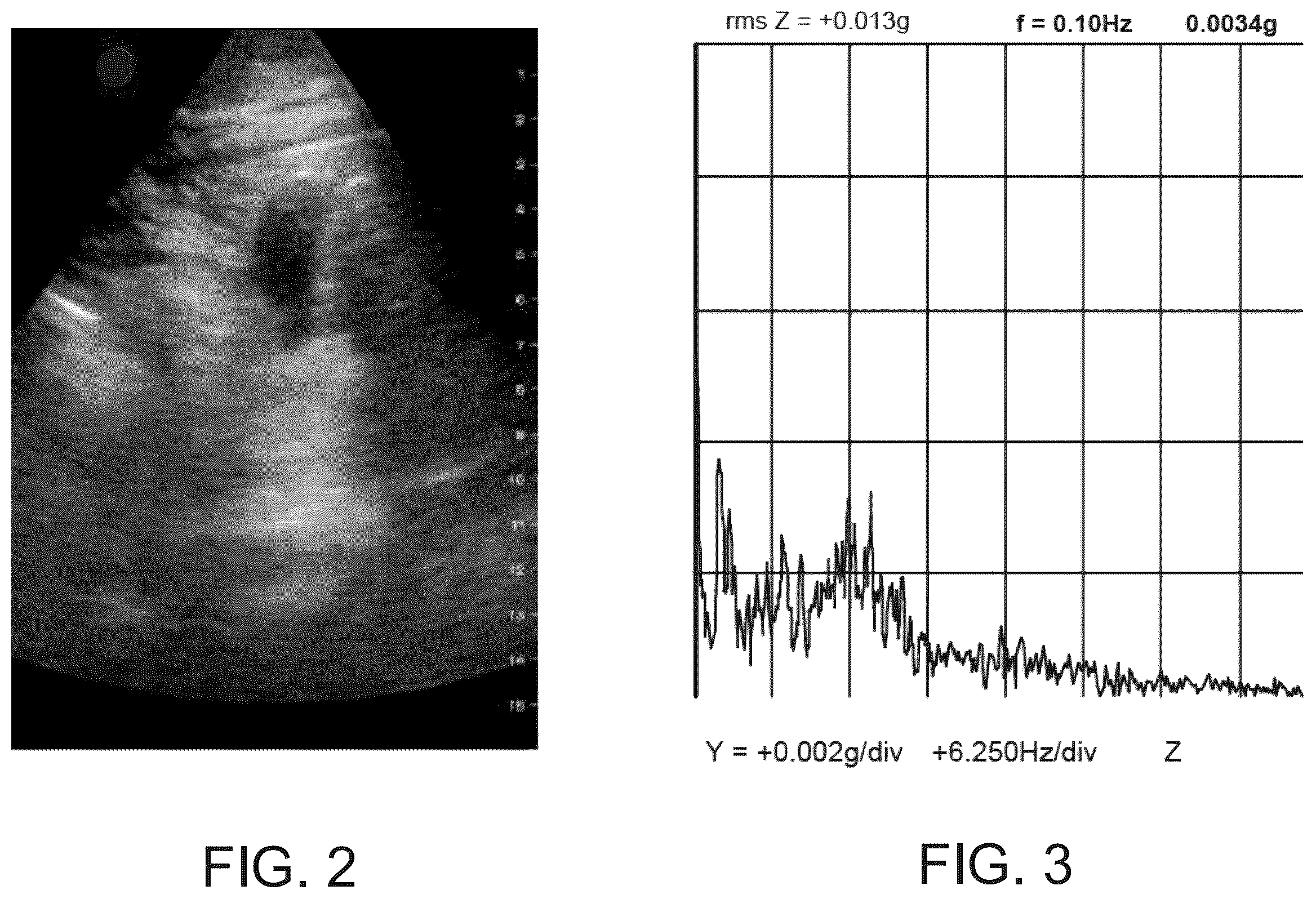 Patent US12333721 Figure 2 – Tissue identification and classification based on vibrational signatures