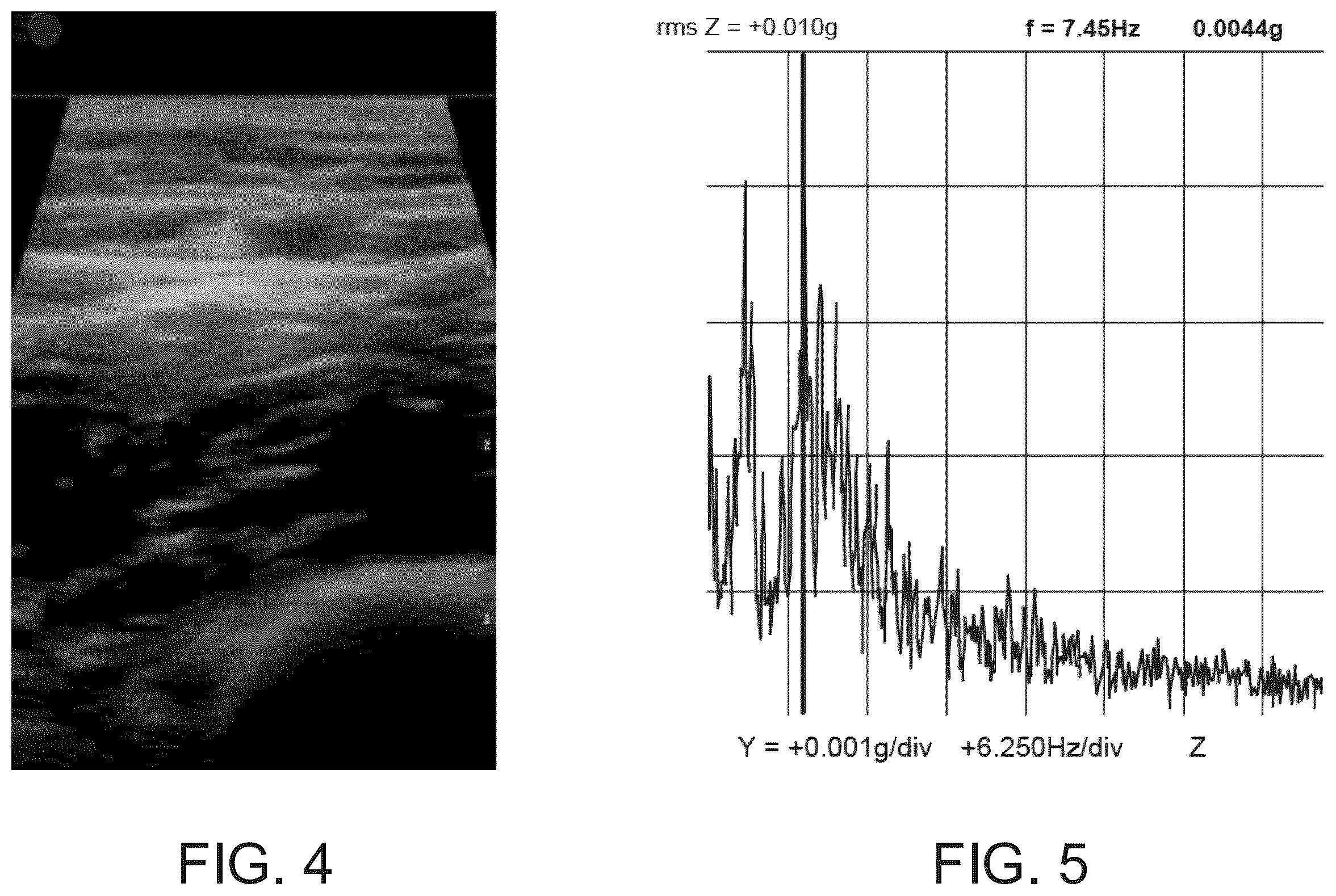 Patent US12333721 Figure 3 – Tissue identification and classification based on vibrational signatures