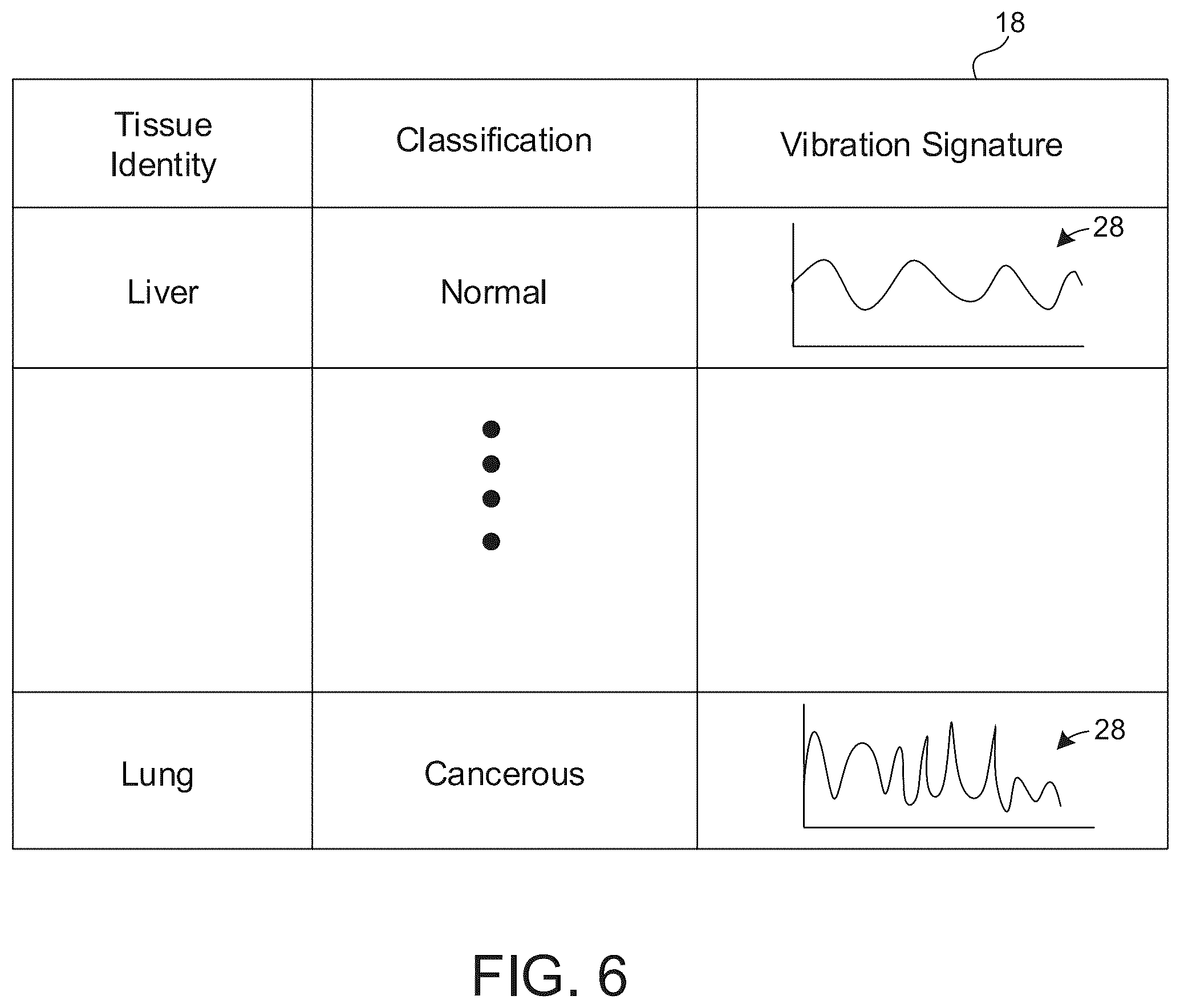 Patent US12333721 Figure 4 – Tissue identification and classification based on vibrational signatures