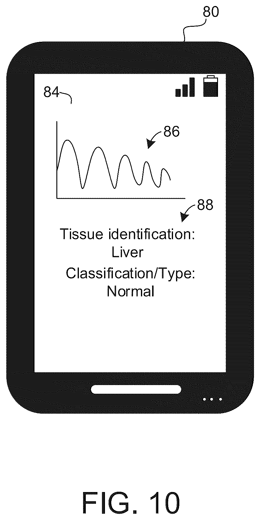 Patent US12333721 Figure 8 – Tissue identification and classification based on vibrational signatures