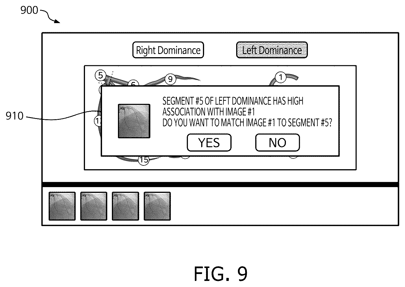 Patent US12333723 Figure 9 – Method and system for computing syntax score using cardio angiogram