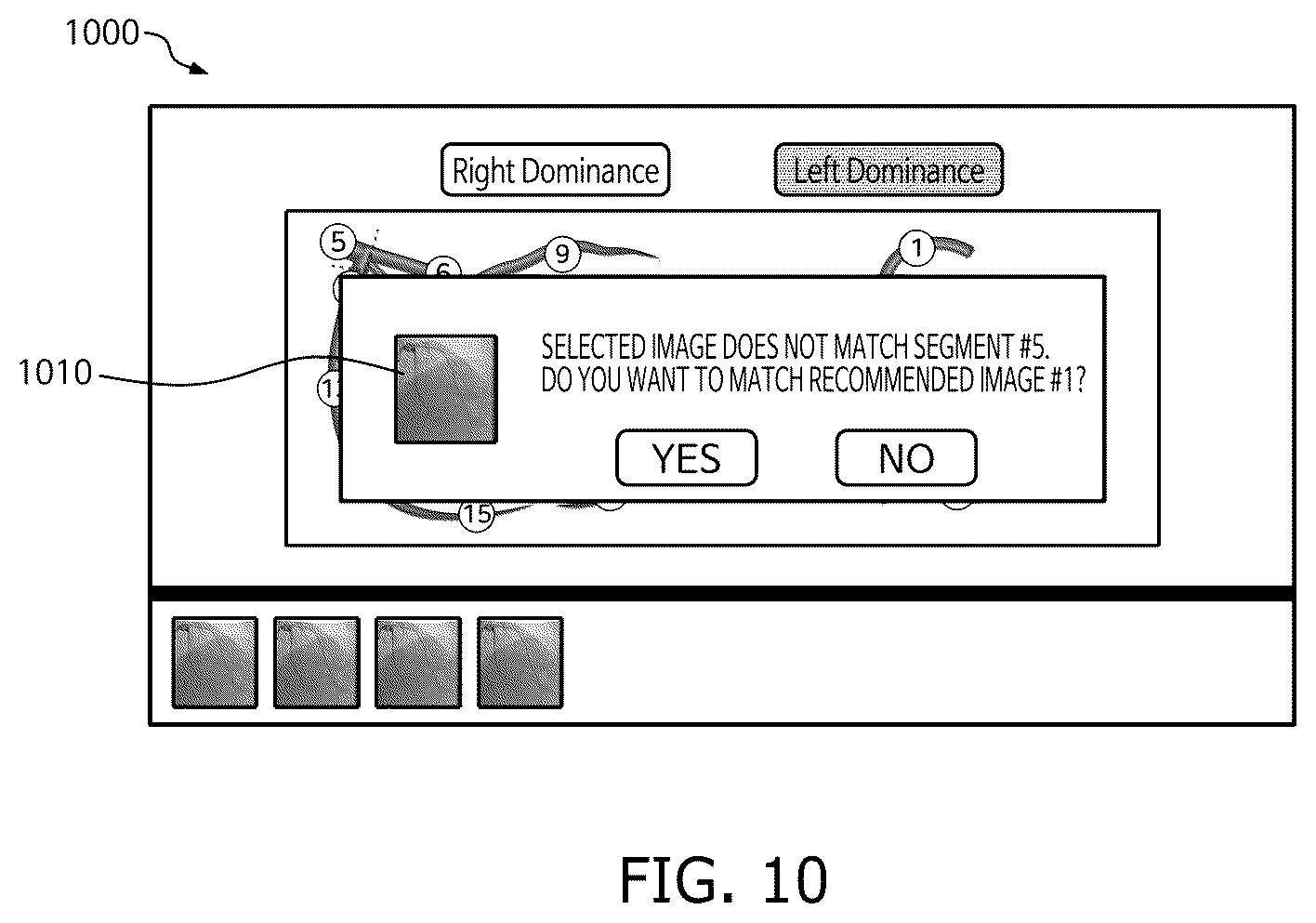 Patent US12333723 Figure 10 – Method and system for computing syntax score using cardio angiogram