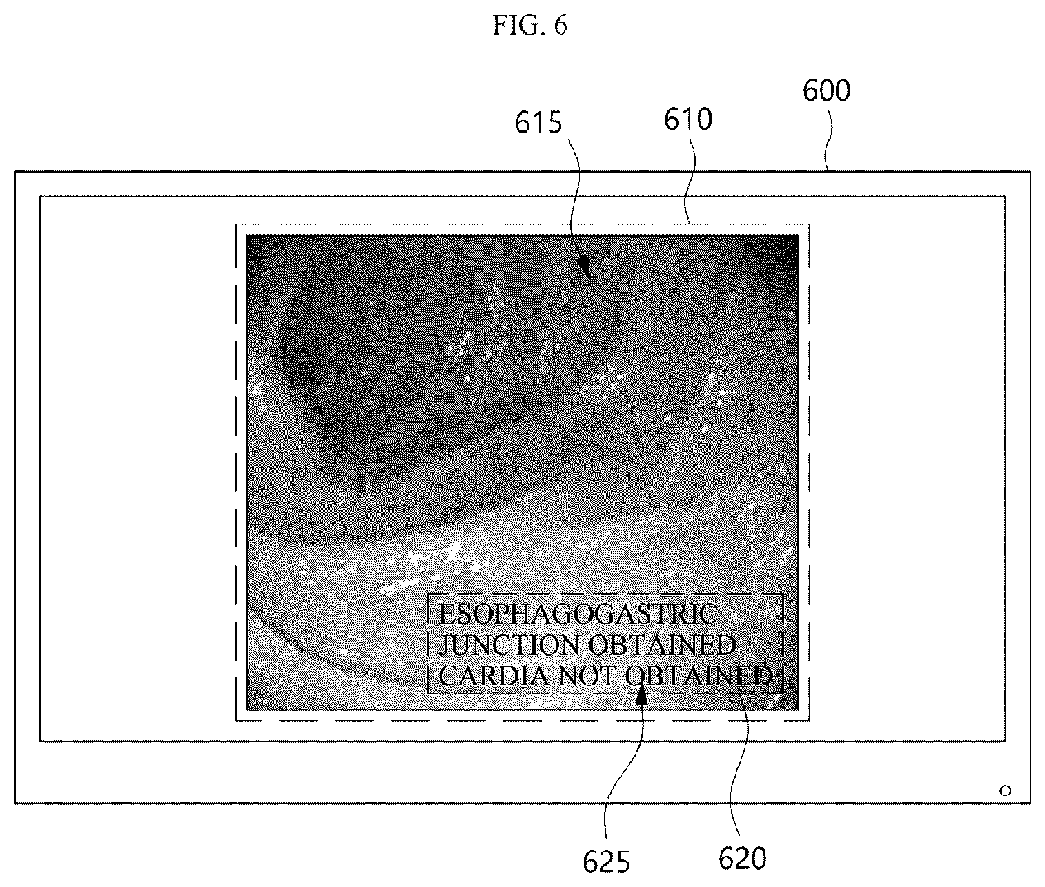Patent US12333724 Figure 6 – Electronic device for analyzing endoscopic images and providing information about a plurality of lesions, and endoscopic examination system including the electronic device