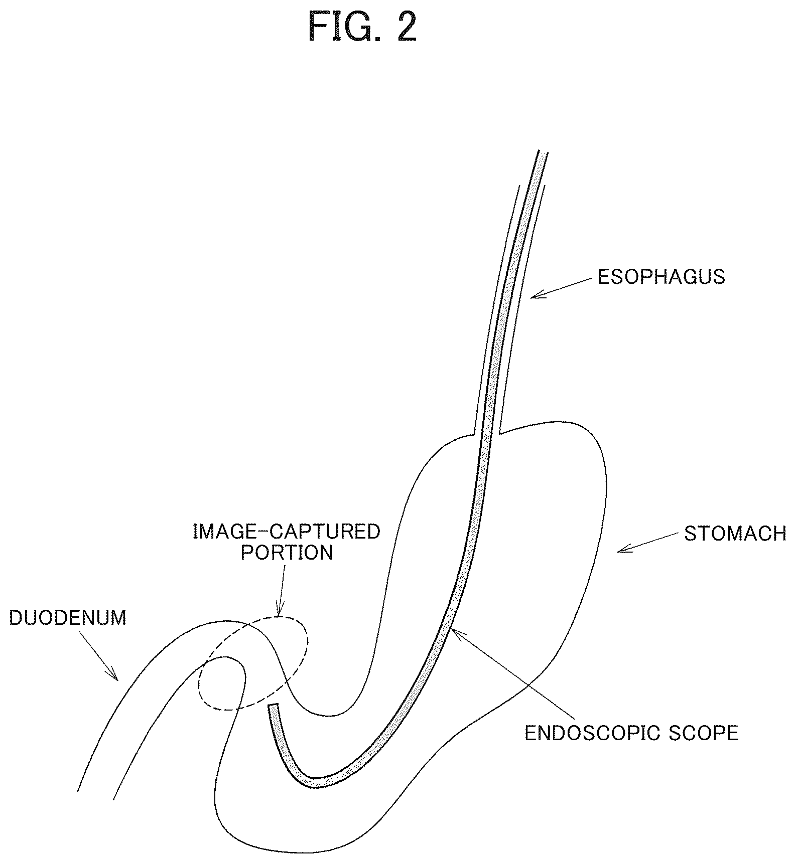 Patent US12333727 Figure 2 – Endoscope apparatus, information processing method, and storage medium
