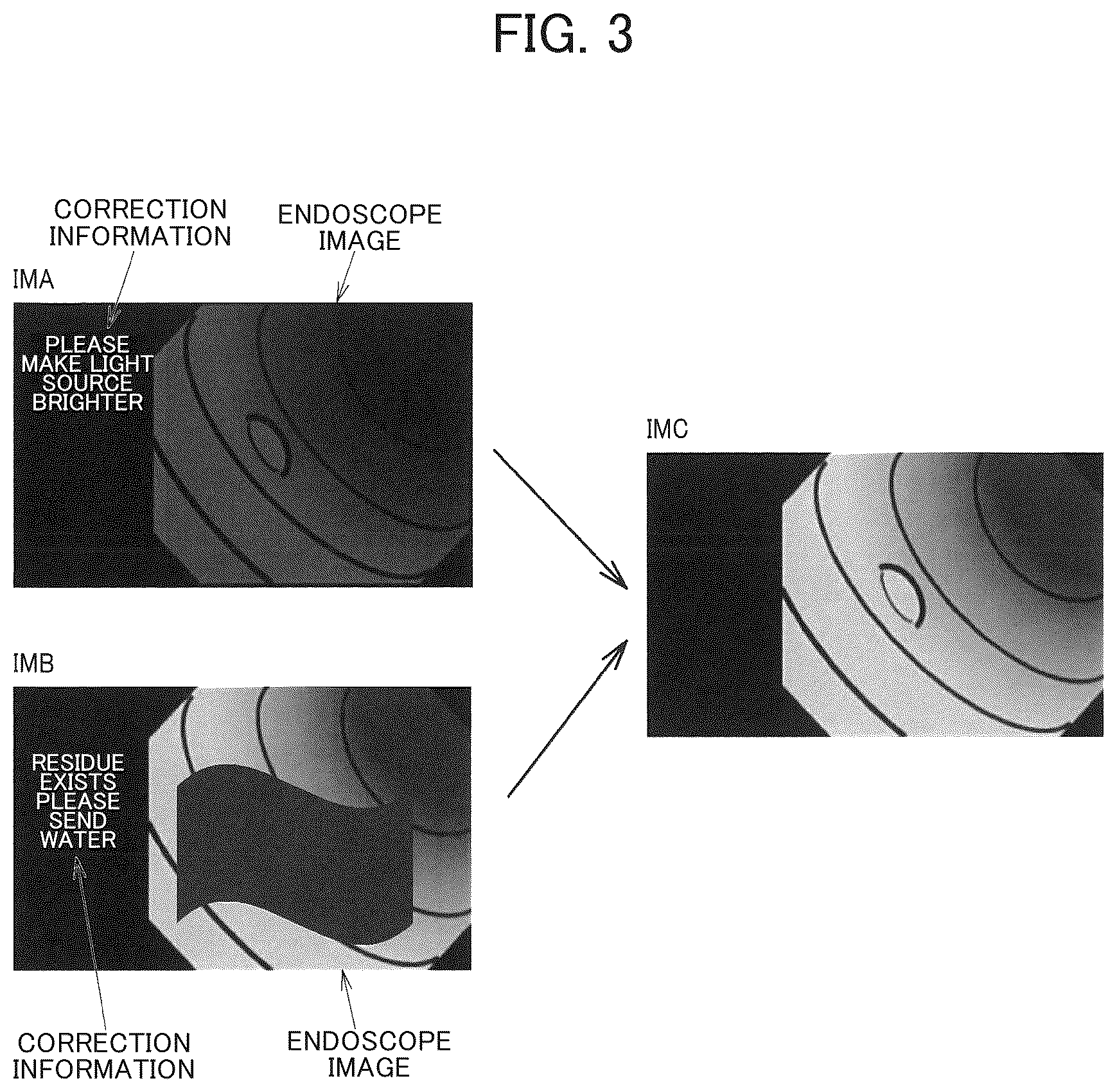 Patent US12333727 Figure 3 – Endoscope apparatus, information processing method, and storage medium