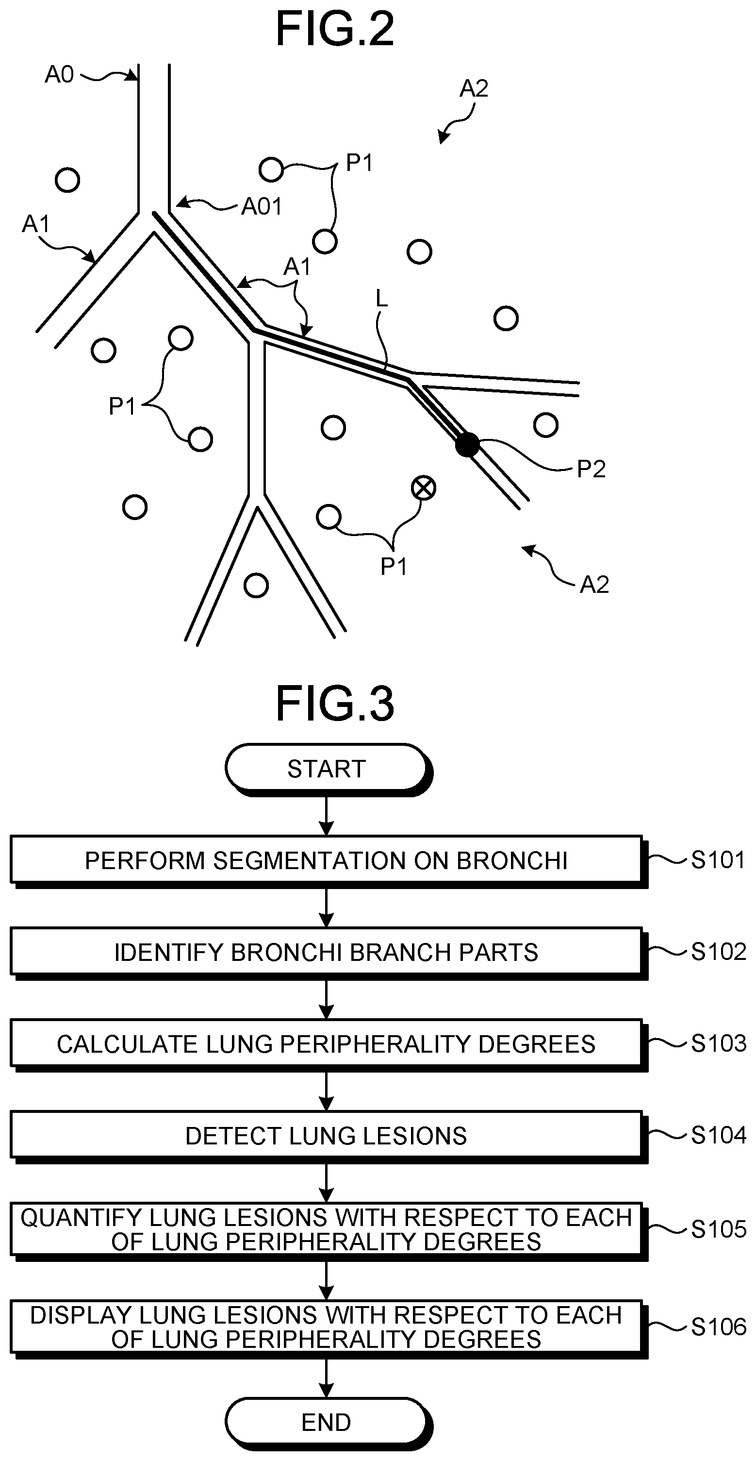 Patent US12333728 Figure 2 – Medical information display apparatus for displaying an index value for the lung, medical image processing apparatus for deriving the index value, and medical information display method for displaying the index value