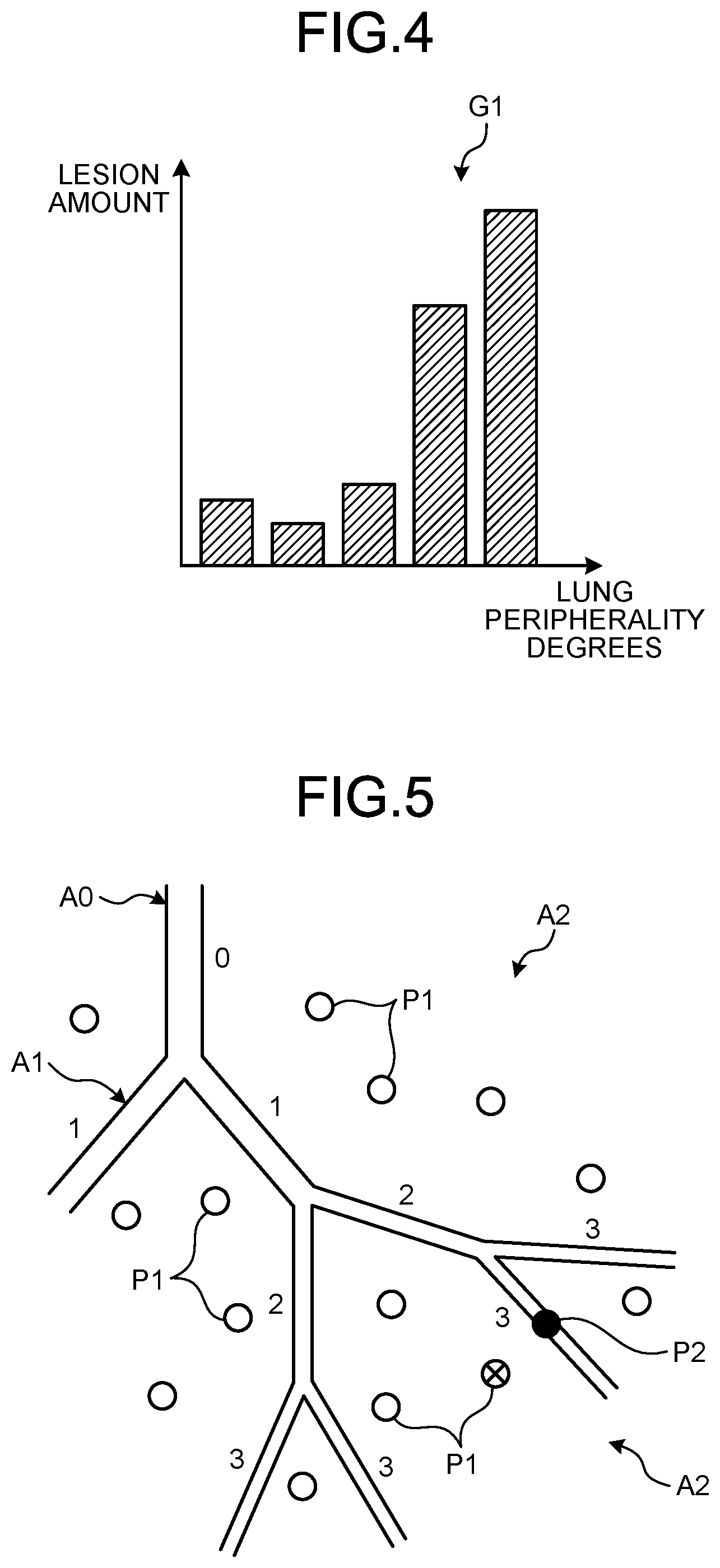 Patent US12333728 Figure 3 – Medical information display apparatus for displaying an index value for the lung, medical image processing apparatus for deriving the index value, and medical information display method for displaying the index value