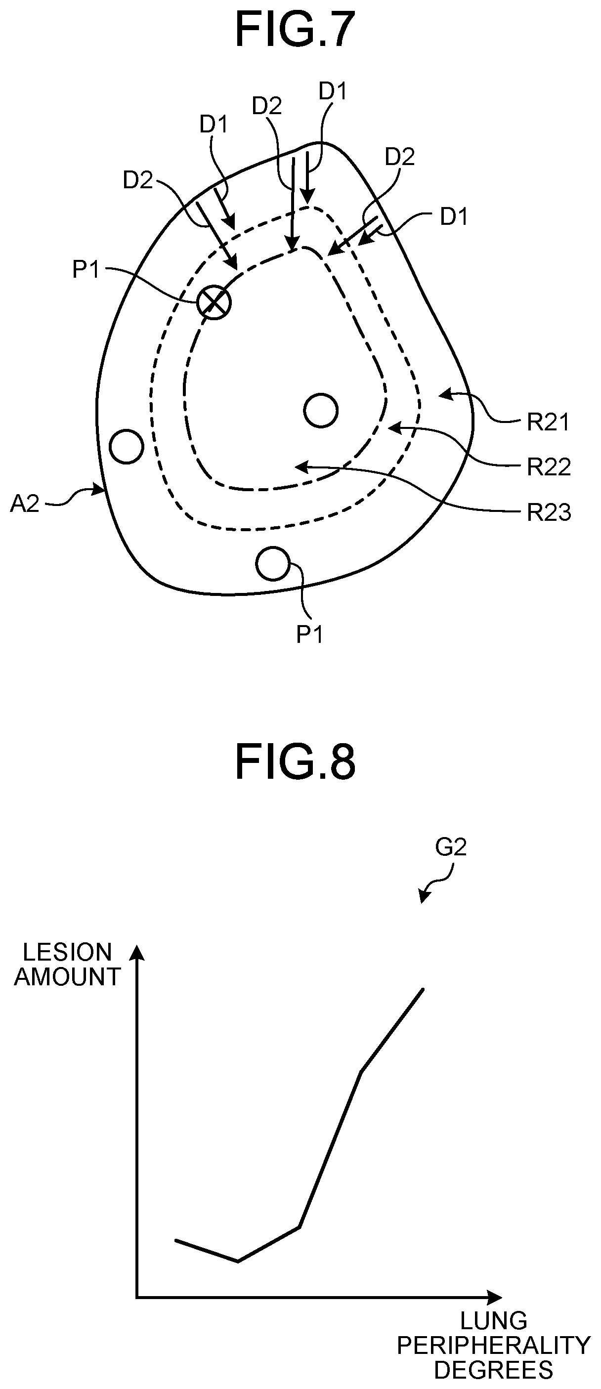 Patent US12333728 Figure 5 – Medical information display apparatus for displaying an index value for the lung, medical image processing apparatus for deriving the index value, and medical information display method for displaying the index value
