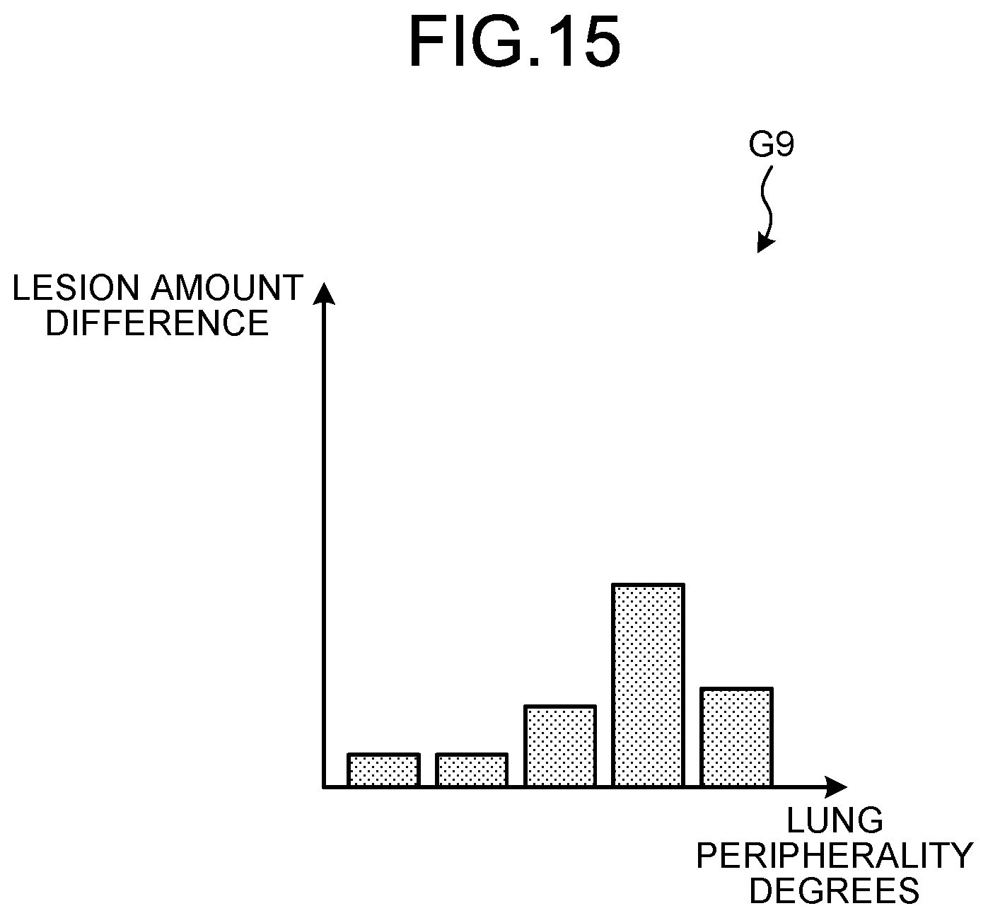 Patent US12333728 Figure 9 – Medical information display apparatus for displaying an index value for the lung, medical image processing apparatus for deriving the index value, and medical information display method for displaying the index value