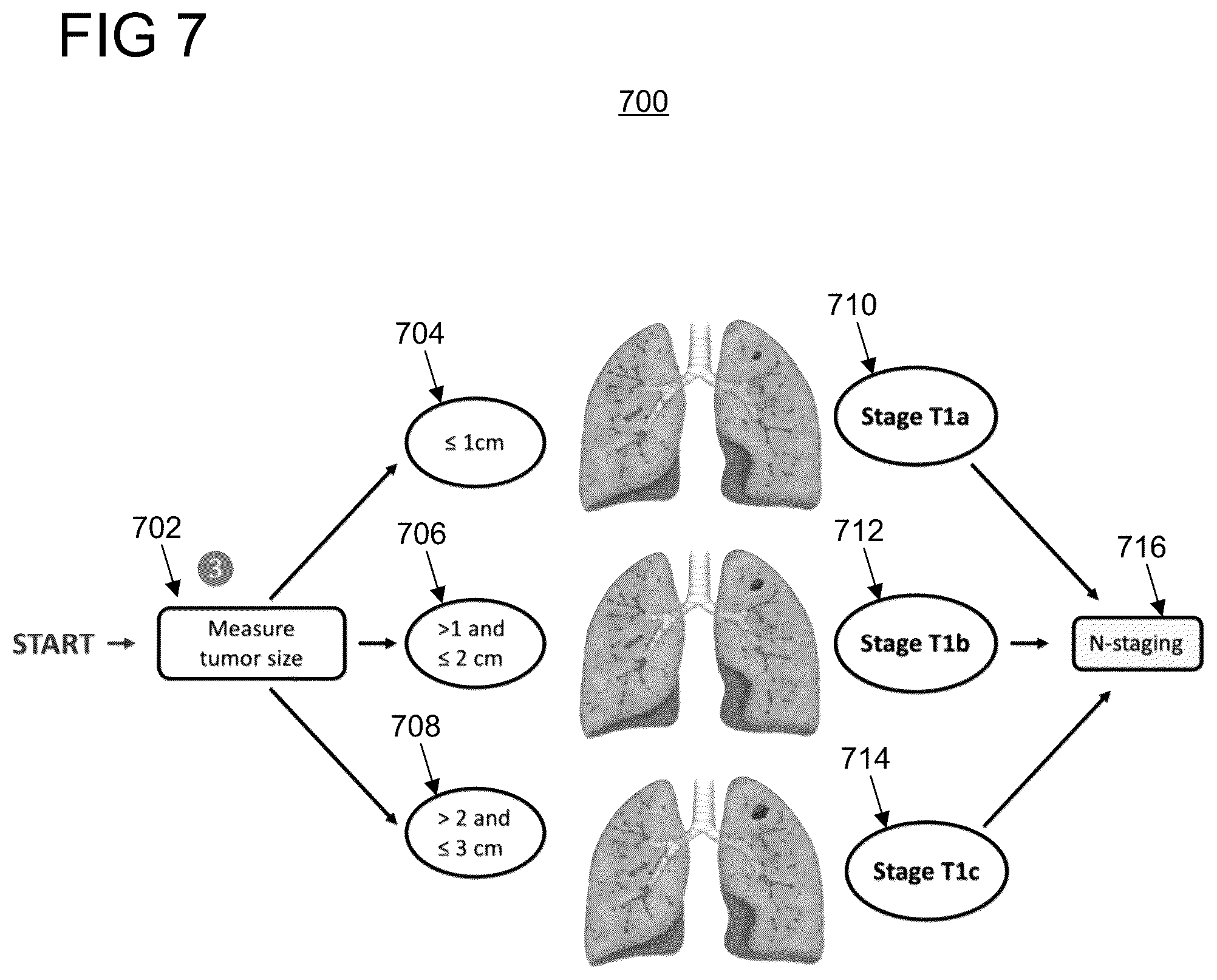 Patent US12333729 Figure 7 – Automatic staging of non-small cell lung cancer from medical imaging and biopsy reports