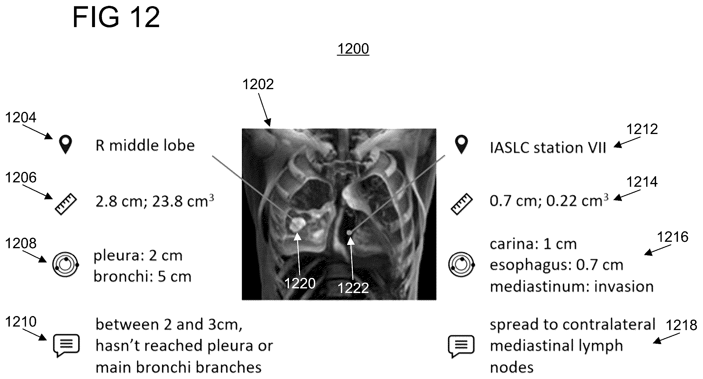 Patent US12333729 Figure 12 – Automatic staging of non-small cell lung cancer from medical imaging and biopsy reports