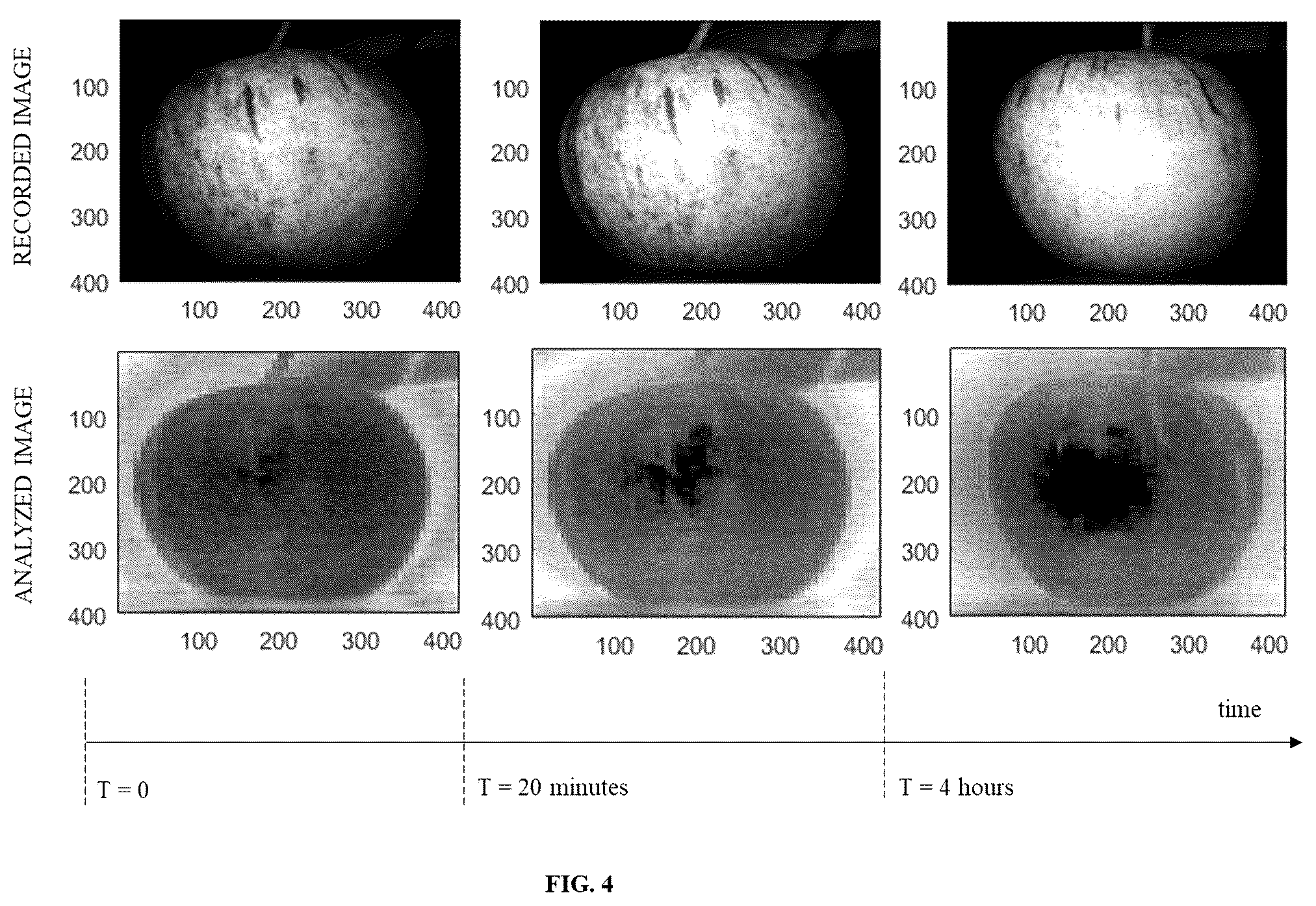 Patent US12333734 Figure 5 – System and method for imaging of localized and heterogeneous dynamics using laser speckle