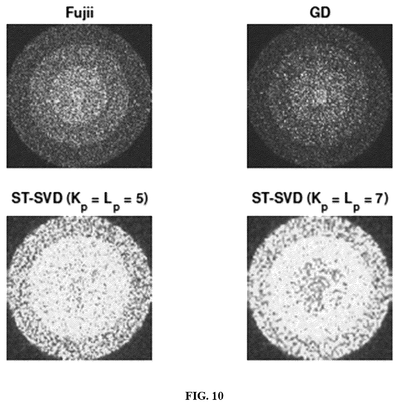 Patent US12333734 Figure 11 – System and method for imaging of localized and heterogeneous dynamics using laser speckle