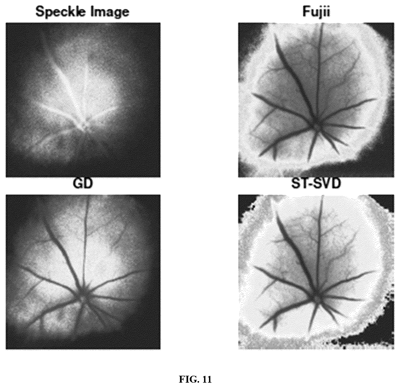 Patent US12333734 Figure 12 – System and method for imaging of localized and heterogeneous dynamics using laser speckle