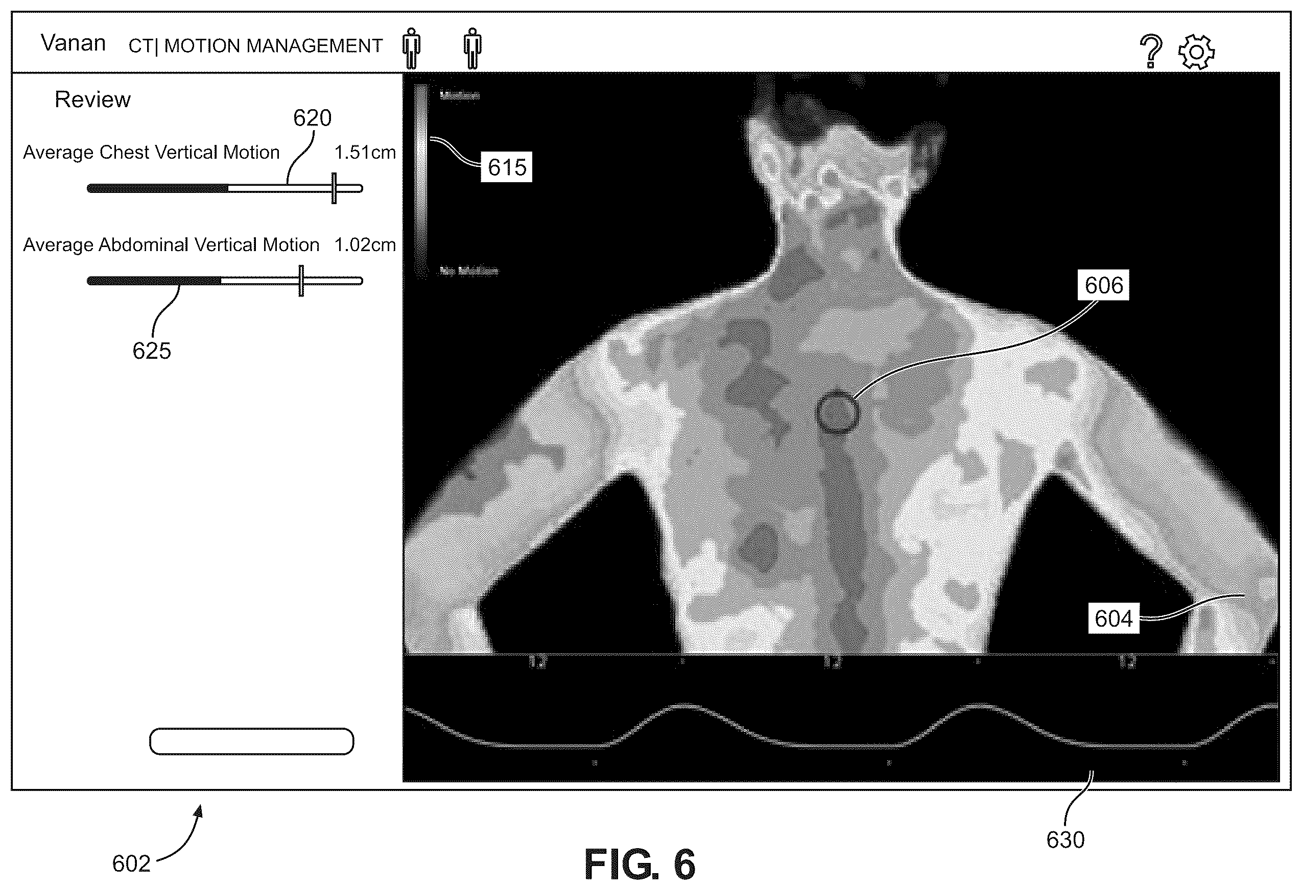 Patent US12333738 Figure 7 – Methods, systems and computer readable mediums for evaluating and displaying a breathing motion