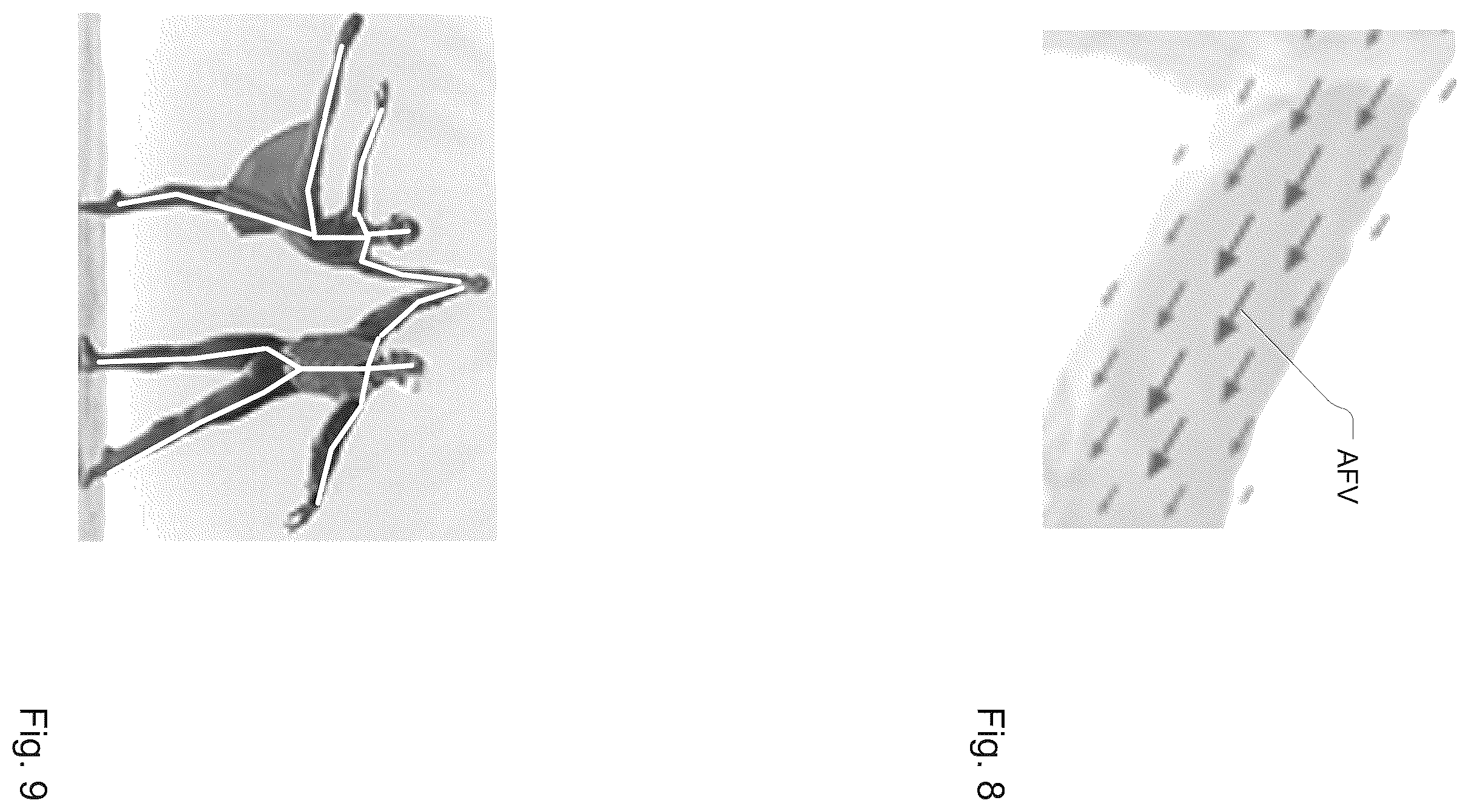 Patent US12333778 Figure 4 – Method and system for keypoint detection based on neural networks