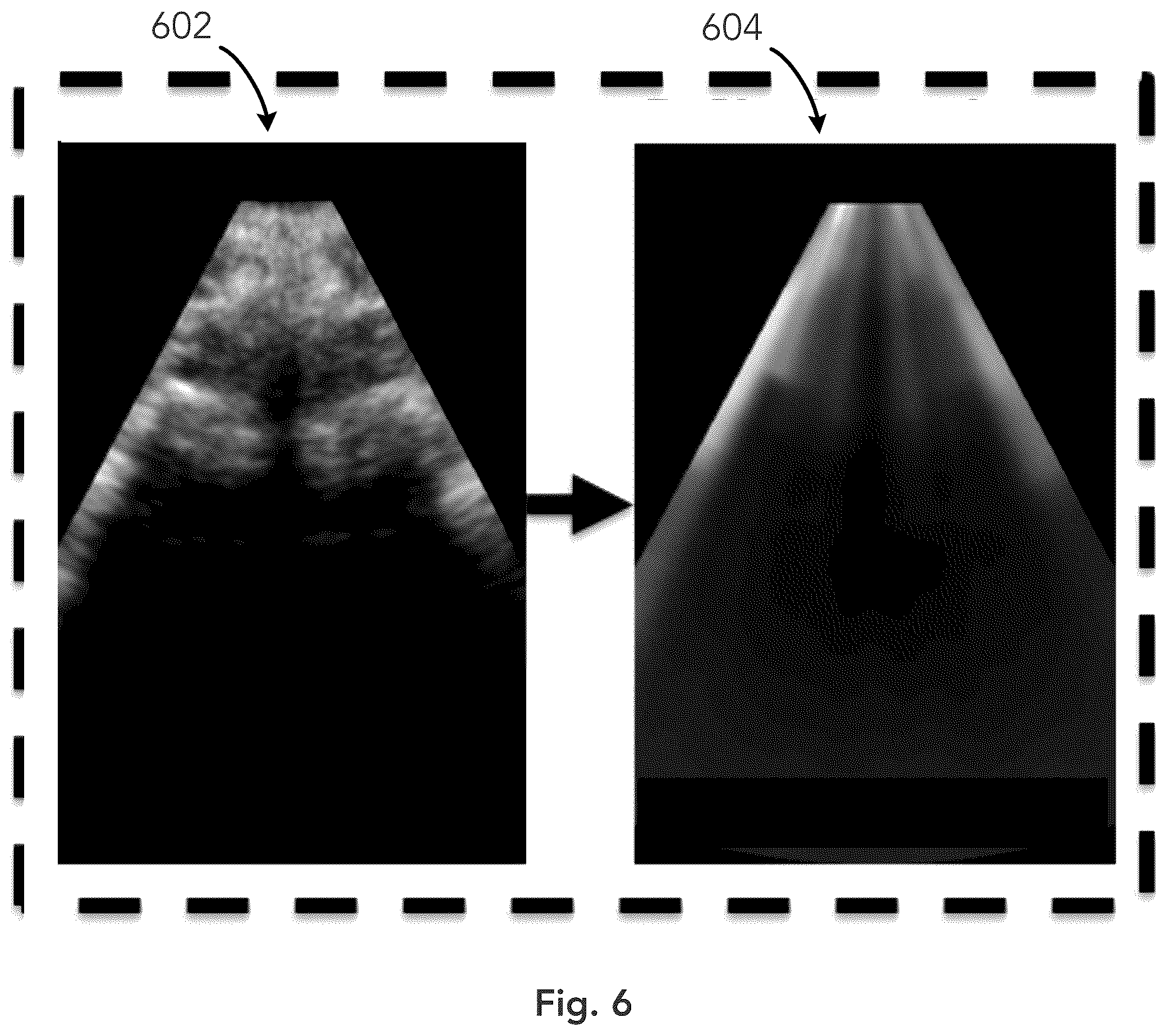 Patent US12333783 Figure 6 – System and method for ultrasound spine shadow feature detection and imaging thereof