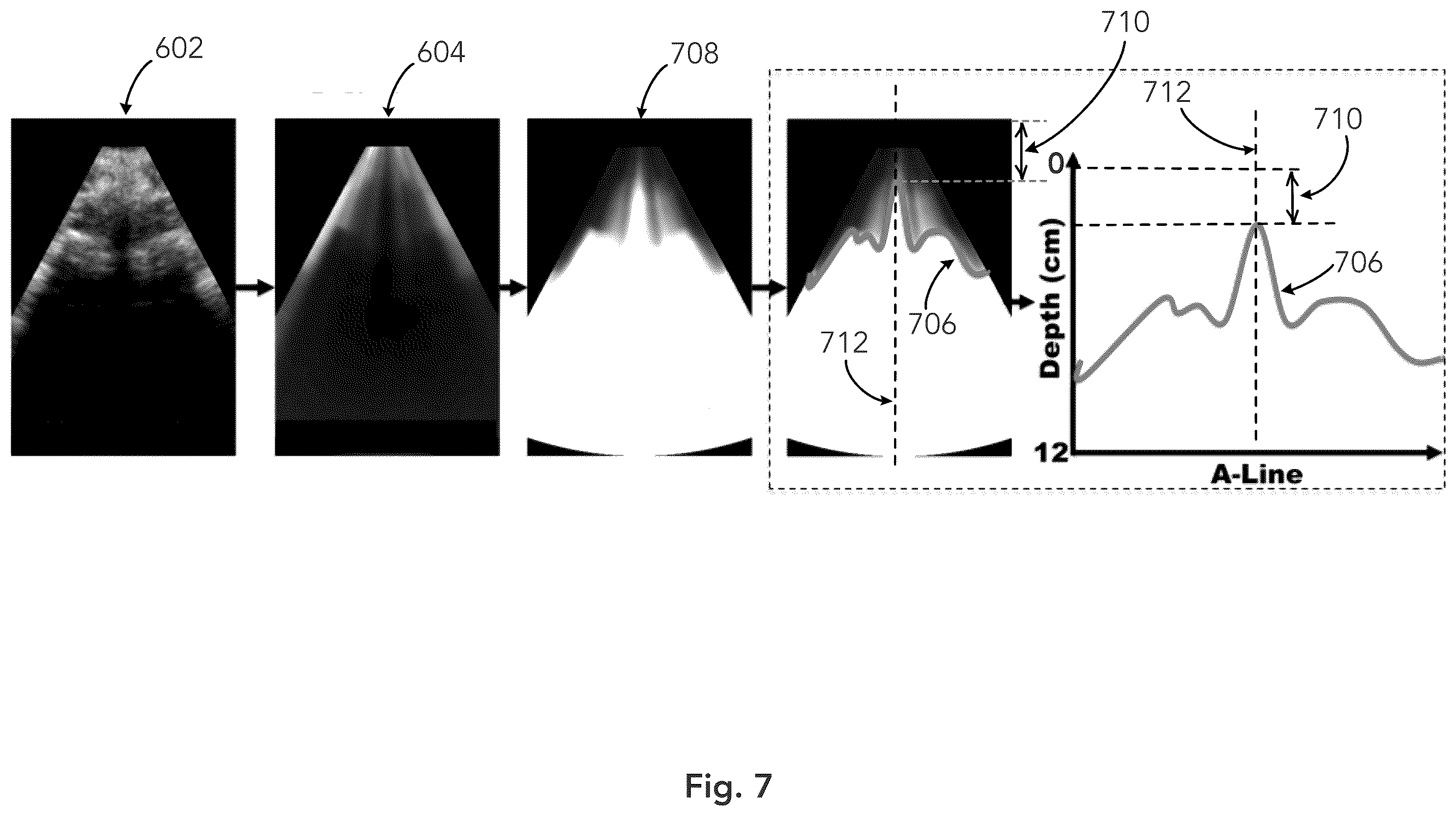 Patent US12333783 Figure 7 – System and method for ultrasound spine shadow feature detection and imaging thereof