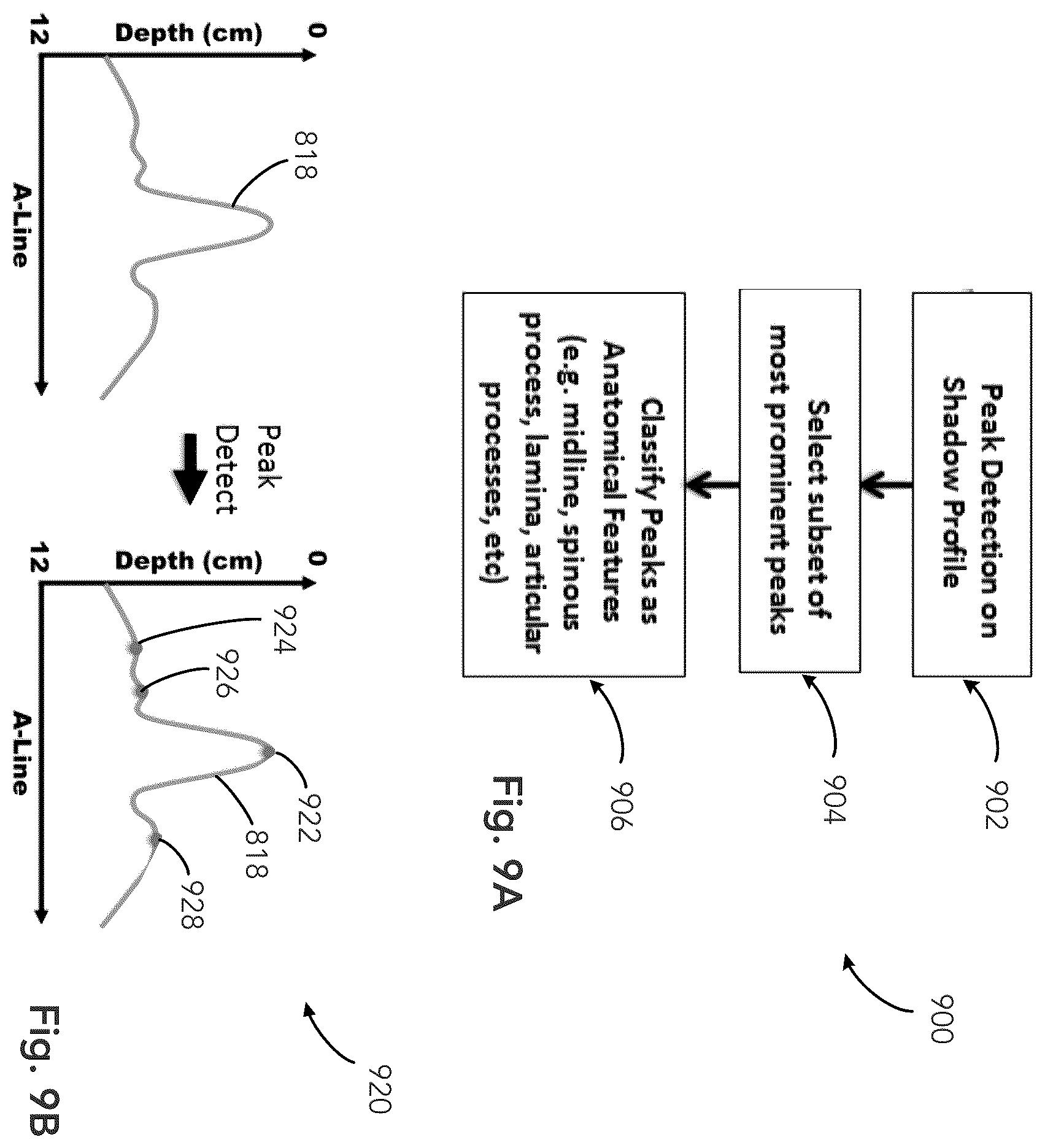 Patent US12333783 Figure 9 – System and method for ultrasound spine shadow feature detection and imaging thereof
