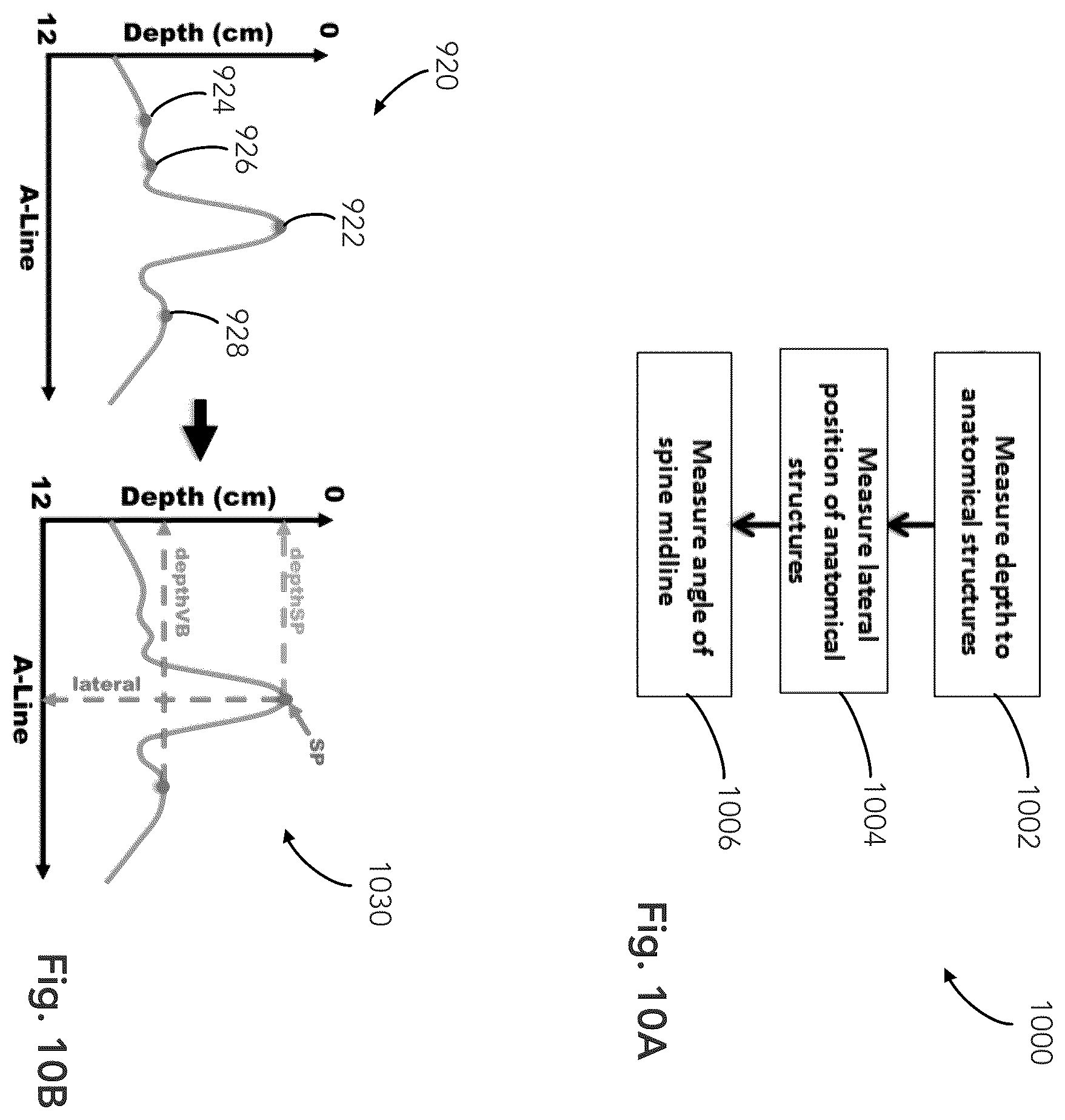 Patent US12333783 Figure 10 – System and method for ultrasound spine shadow feature detection and imaging thereof