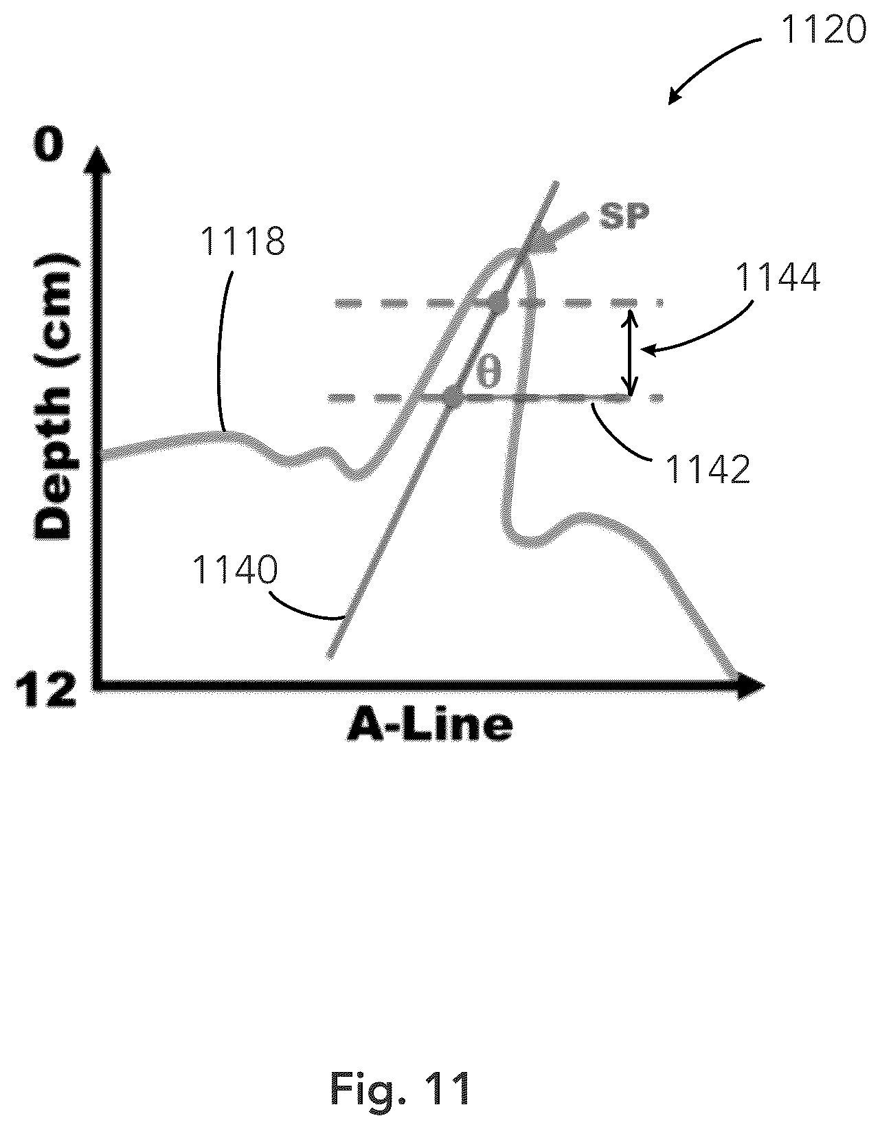 Patent US12333783 Figure 11 – System and method for ultrasound spine shadow feature detection and imaging thereof
