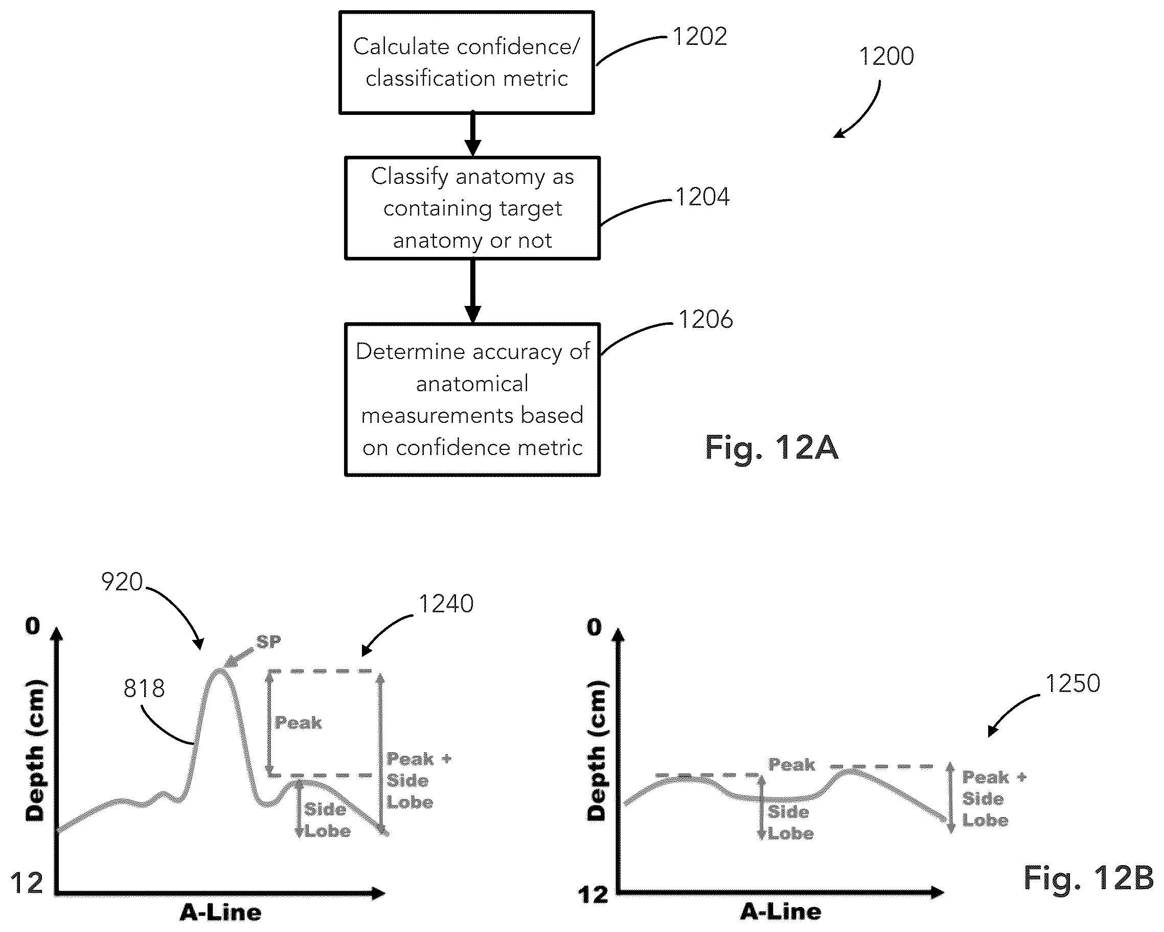 Patent US12333783 Figure 12 – System and method for ultrasound spine shadow feature detection and imaging thereof