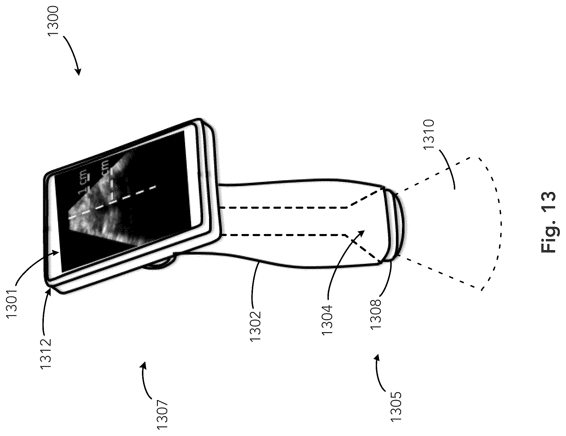 Patent US12333783 Figure 13 – System and method for ultrasound spine shadow feature detection and imaging thereof