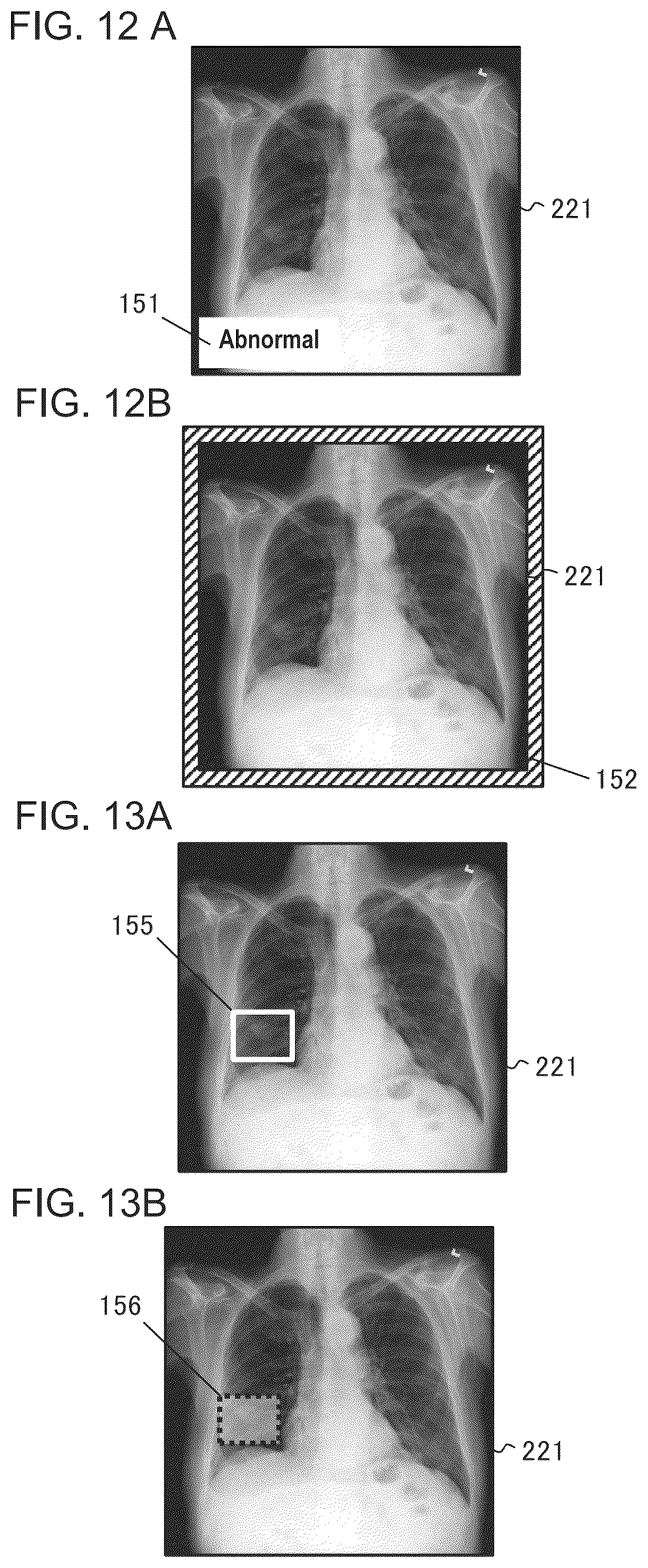 Patent US12333790 Figure 8 – Diagnostic assistance apparatus and model generation apparatus