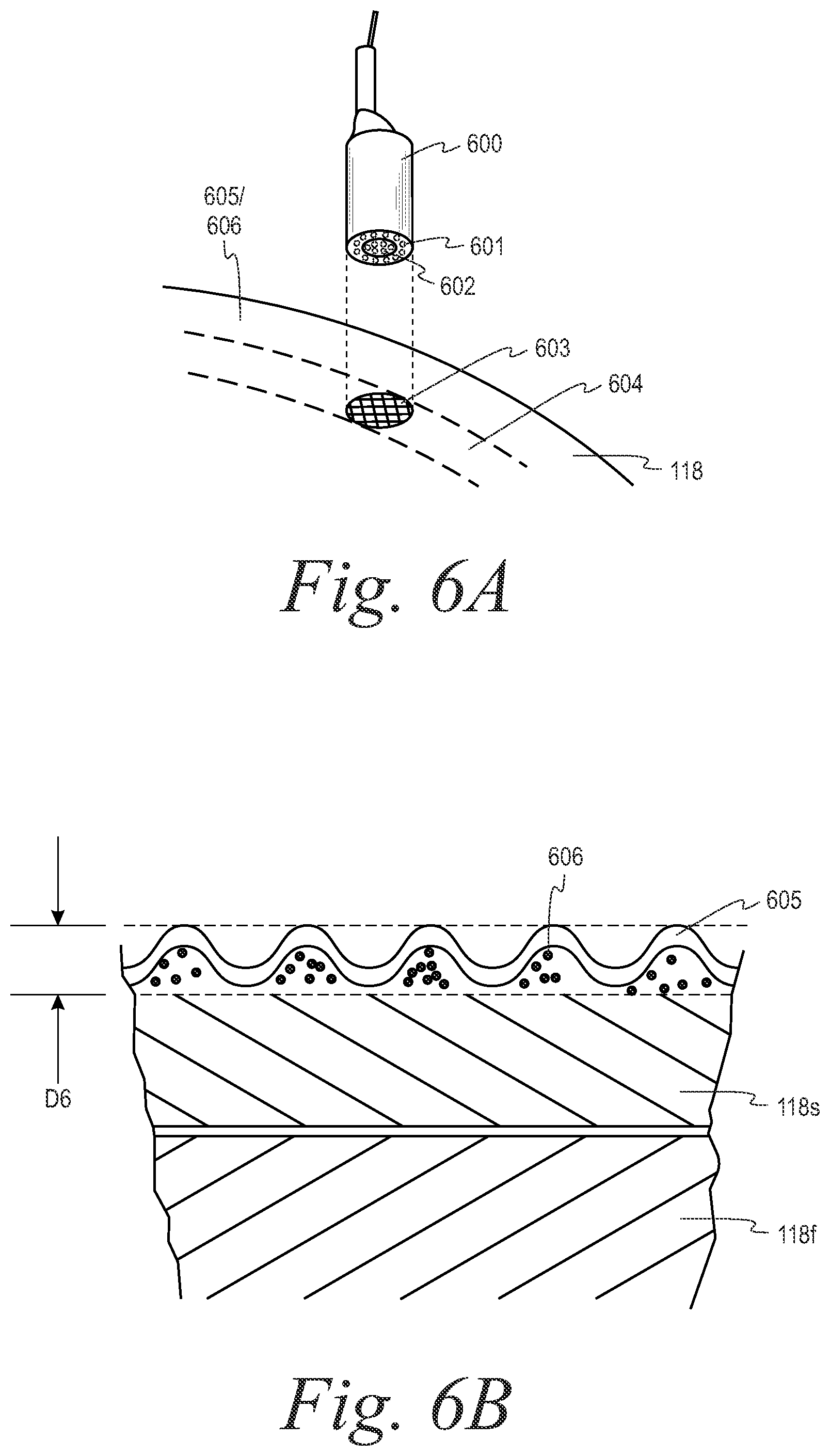 Patent US12333886 Figure 14 – Coin pad for coin processing system