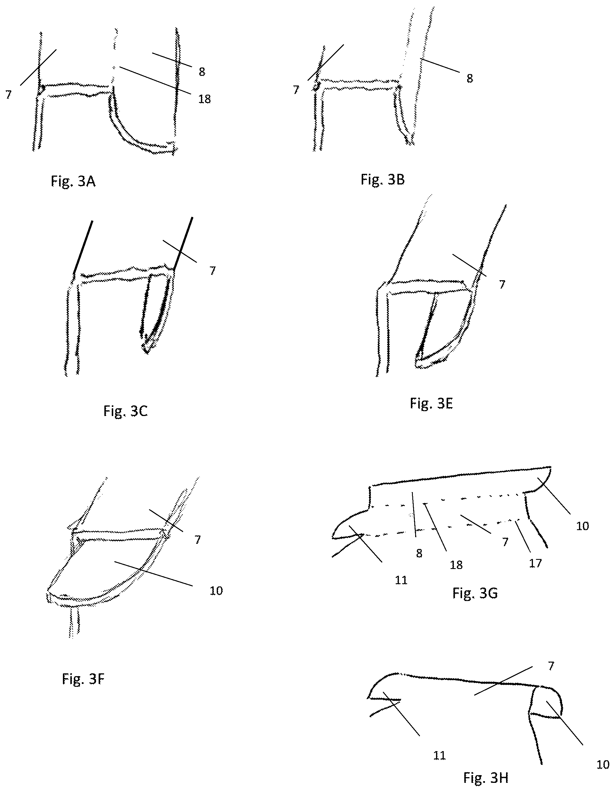 Patent US12338039 Figure 2 – Cardboard box for holding content, and a method for using such